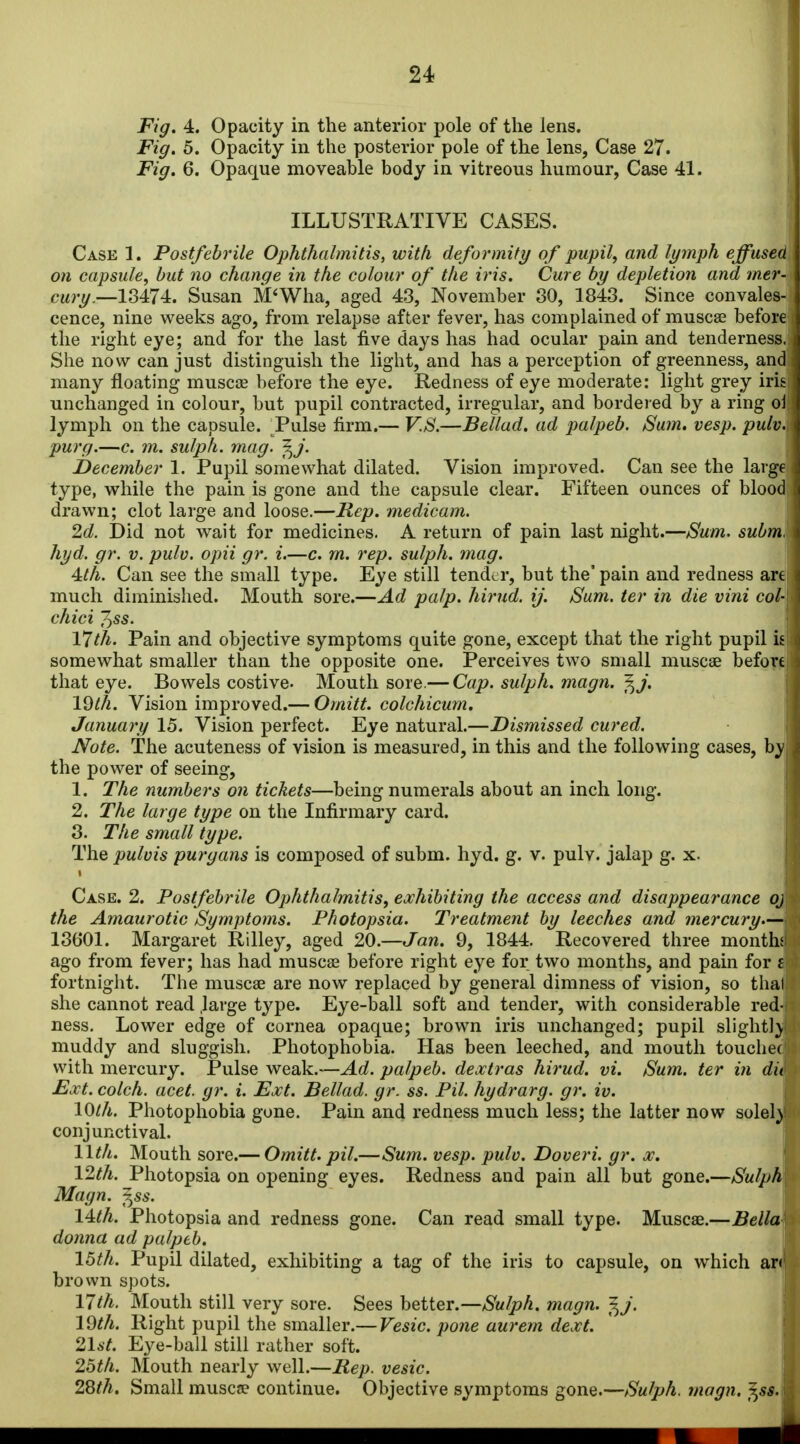 Fig, 4. Opacity in the anterior pole of the lens. Fig. 5. Opacity in the posterior pole of the lens, Case 27. I Fig. 6. Opaque moveable body in vitreous humour, Case 41. , ILLUSTRATIVE CASES. Case 1. Postfebrile Ophthalmitis, with deformity of pupil, and lymph effused on capsule, hut no change in the colour of the iris. Cure by depletion and mer- cury.—13474. Susan M*Wha, aged 43, November 30, 1843. Since convales- cence, nine weeks ago, from relapse after fever, has complained of muscse before i the right eye; and for the last five days has had ocular pain and tenderness..^ She now can just distinguish the light, and has a perception of greenness, and many floating musca3 before the eye. Redness of eye moderate: light grey irisi unchanged in colour, but pupil contracted, irregular, and bordered by a ring oil lymph on the capsule. Pulse firm.— V.S.—Bellad. ad palpeb. Sum. vesp. pulv.i purg.—c. m. sulph. mag. f^j. December 1. Pupil somewhat dilated. Vision improved. Can see the large type, while the pain is gone and the capsule clear. Fifteen ounces of blood drawn; clot large and loose.—Rep. medicam. 2d. Did not wait for medicines. A return of pain last night.—Sum. subm. hyd. gr. v. pulv. opii gr. i.—c. m. rep. sulph. mag. Ath. Can see the small type. Eye still tender, but the' pain and redness ar€ ' much diminished. Mouth sore.—Ad palp, hirud. ij. Sum. ter in die vini col- chici ^ss. 17th. Pain and objective symptoms quite gone, except that the right pupil ie somewhat smaller than the opposite one. Perceives two small muscae before that eye. Bowels costive- Mouth sore.— Cap. sulph. magn. ^j. IQth. Vision improved.— Omitt. colchicum. January 15. Vision perfect. Eye natural.—Dismissed cured. Note. The acuteness of vision is measured, in this and the following cases, b^ the power of seeing, 1. The numbers on tickets—being numerals about an inch long. 2. The large type on the Infirmary card. 8. The small type. The pulvis purgans is composed of subm. hyd. g. v. pulv. jalap g. x. Case. 2. Postfebrile Ophthalmitis, exhibiting the access and disappearance oj the Amaurotic Symptoms. Photopsia. Treatment by leeches and mercury— 13601. Margaret Rilley, aged 20.—Jan. 9, 1844. Recovered three month; ago from fever; has had muscse before right eye for two months, and pain for i fortnight. The muscae are now replaced by general dimness of vision, so thai she cannot read .large type. Eye-ball soft and tender, with considerable red- ness. Lower edge of cornea opaque; brown iris unchanged; pupil slight!) muddy and sluggish. Photophobia. Has been leeched, and mouth toucliec with mercury. Pulse weak.—Ad. palpeb. deoctras hirud. vi. Sum. ter in du Ext. colch. acet. gr. i. Ext. Bellad. gr. ss. Pil. hydrarg. gr. iv. 10th. Photophobia gone. Pain and redness much less; the latter now solel} conjunctival. llth. Mouth sore.— Omitt. pil.—Sum. vesp. pulv. Doveri. gr. x. 12th. Photopsia on opening eyes. Redness and pain all but gone.—Sulph Magn. f^ss. 14:th. Photopsia and redness gone. Can read small type. Muscae.—Bella donna ad palpeb. 15th. Pupil dilated, exhibiting a tag of the iris to capsule, on which ar* brown spots. 17//i. Mouth still very sore. Sees heitei.—Sulph. magn. ^J. 19th. Right pupil the smaller.— Vesic. pone aurem dext. 21st. Eye-ball still rather soft. 2bth. Mouth nearly well.—Rep. vesic. 2Sth. Small musca? continue. Objective symptoms gone.—Sulph. magn. ^ss. i