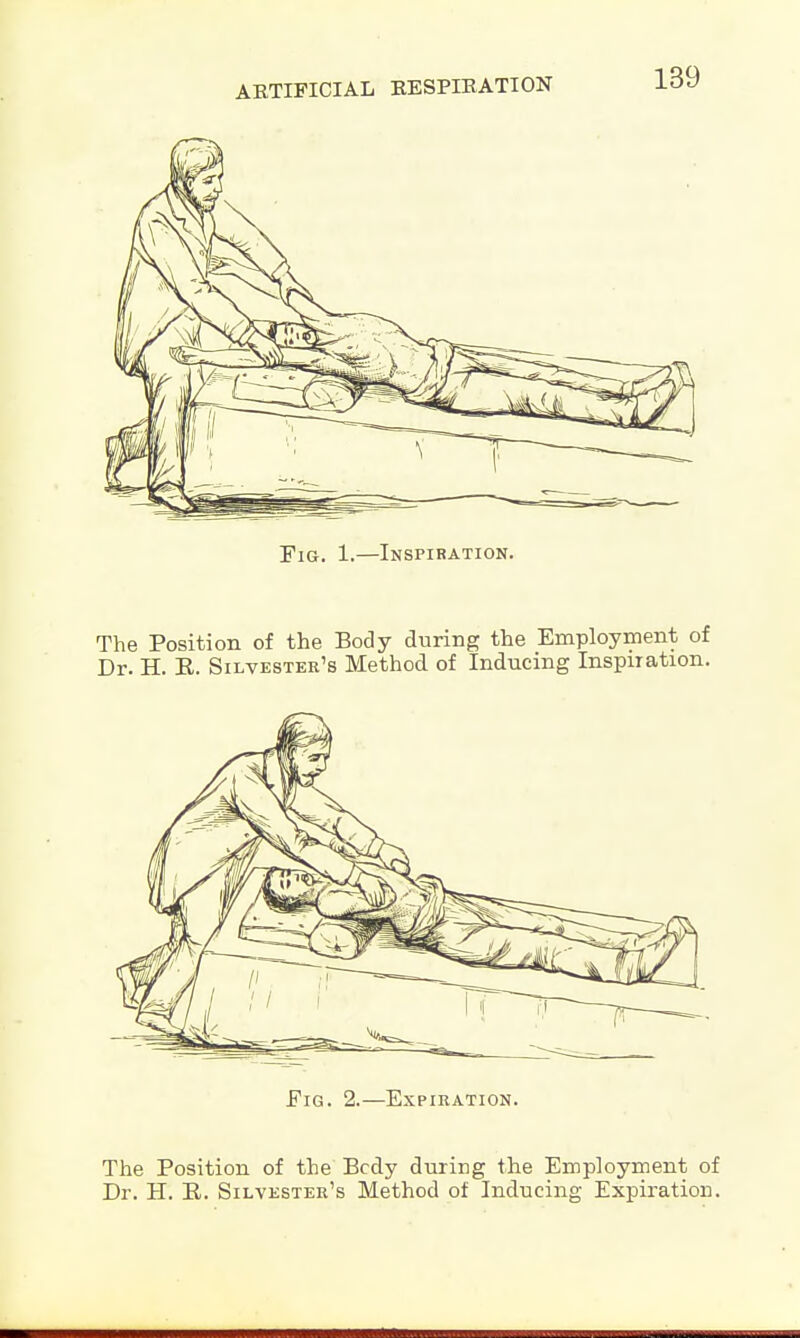 Fig. 1.—Inspiration. The Position of the Body during the Employment of Dr. H. E. Silvester's Method of Inducing Inspiration. The Position of the Bcdy during the Employment of Dr. H. R. Silvester's Method of Inducing Expiration.