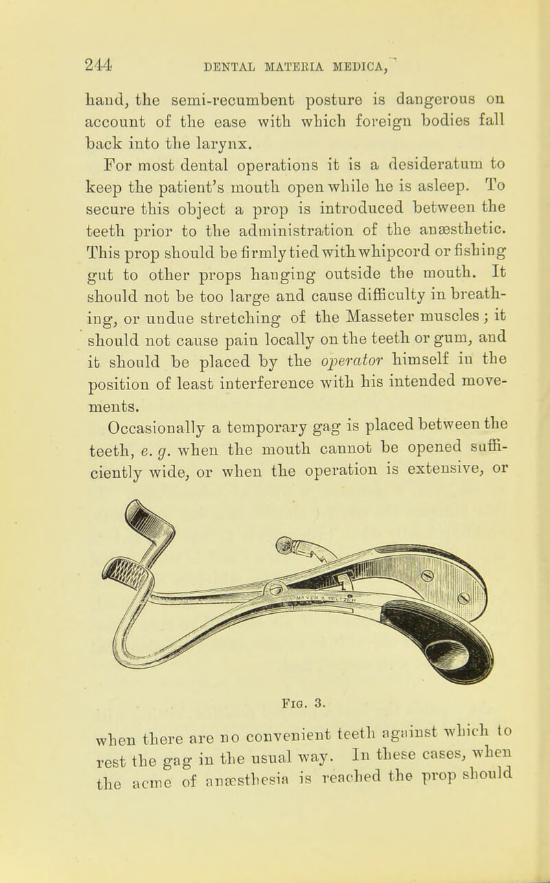 haud, the semi-recumbent posture is dangerous on account of the ease with which foreign bodies fall back into the larynx. For most dental operations it is a desideratum to keep the patient's mouth open while he is asleep. To secure this object a prop is introduced between the teeth prior to the administration of the anaesthetic. This prop should be firmly tied with whipcord or fishing gut to other props hanging outside the mouth. It should not be too large and cause difficulty in breath- ing, or undue stretching of the Masseter muscles ; it should not cause pain locally on the teeth or gum, and it should be placed by the operator himself in the position of least interference with his intended move- ments. Occasionally a temporary gag is placed between the teeth, e. g. when the mouth cannot be opened suffi- ciently wide, or when the operation is extensive, or Fig. 3. when there are no convenient teeth agninst which to rest the gag in the usual way. In these cases, when the acme of anEEsthesia is reached the prop should