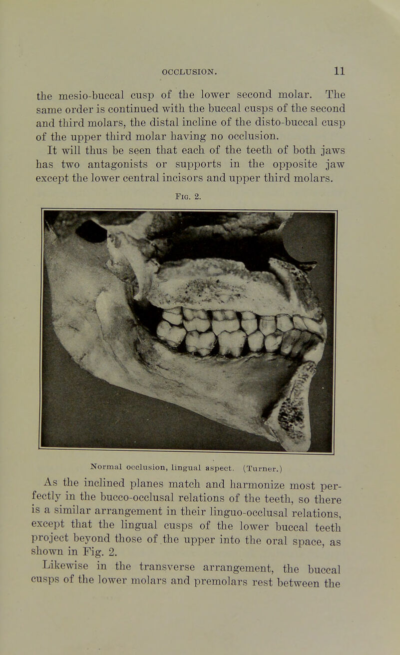 the mesio-buccal cusp of the lower second molar. The same order is continued with the buccal cusps of the second and third molars, the distal incline of the disto-buccal cusp of the upper third molar having no occlusion. It will thus be seen that each of the teeth of both jaws has two antagonists or supports in the opposite jaw except the lower central incisors and upper third molars. Fig. 2. Normal occlusion, lingual aspect. (Turner.) As the inclined planes match and harmonize most per- fectly in the bucco-occlusal relations of the teeth, so there is a similar arrangement in their linguo-occlusal relations, except that the lingual cusps of the lower buccal teeth project beyond those of the upper into the oral space, as shown in Fig. 2. ' Likewise in the transverse arrangement, the buccal cusps of the lower molars and premolars rest between the