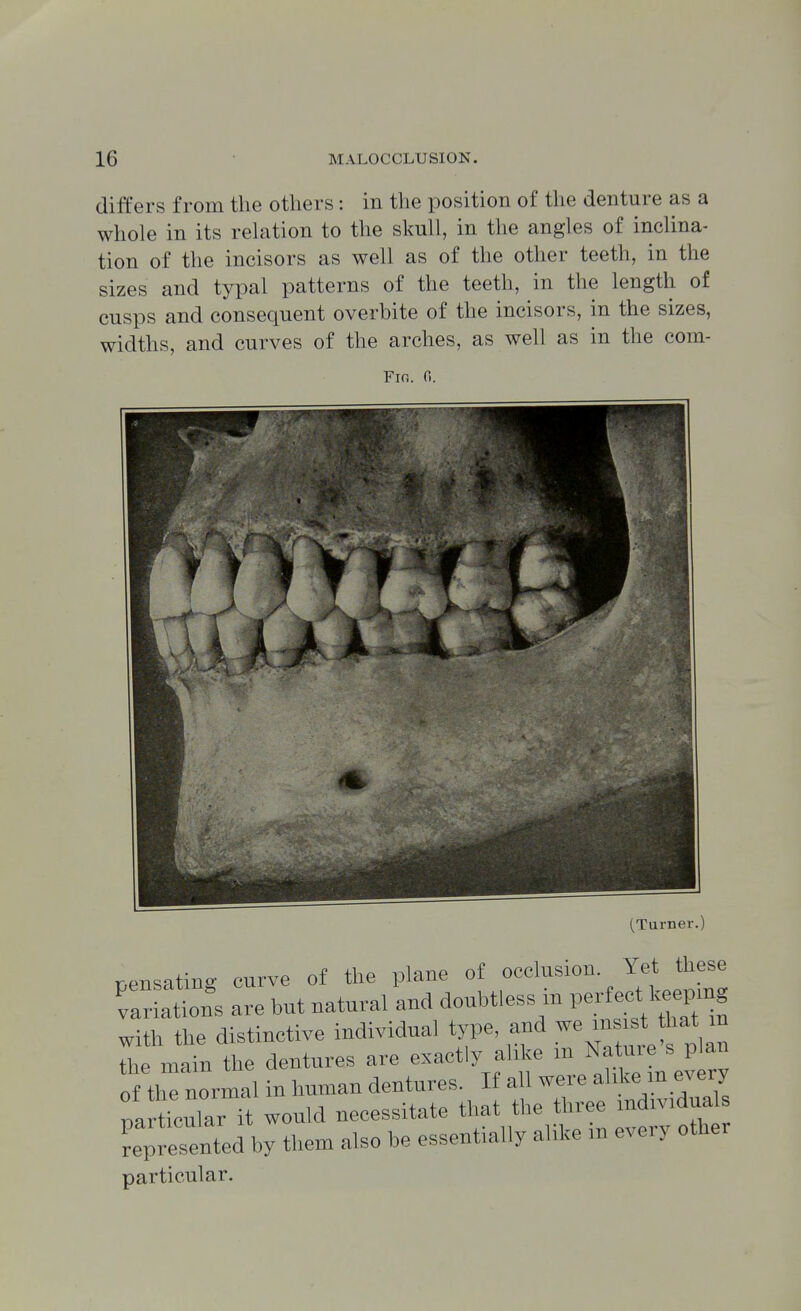 differs from the others : in tlie position of the denture as a whole in its rehition to the skull, in the angles of inclina- tion of the incisors as well as of the other teeth, in the sizes and typal patterns of the teeth, in the length of cusps and consequent overbite of the incisors, in the sizes, widths, and curves of the arches, as well as in the com- Fio. 0. (Turner.) censatinK curve of the plane of occlusion. Yet these var a^ns are but natural and doubtless in V<^r{eet^^ms with the distinctive individual type, and we insist hat m fte main the dentures are exactly alike in Nature's plan 0 tirnormal in human dentures. If all were alike m every paSr it would necessitate the t n-ee individua represented by them also be essentially alike in eveiy other particular.