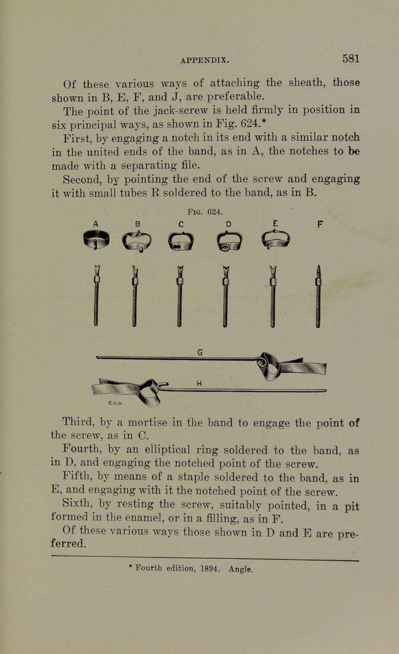 Of these various ways of attaching the sheath, those shown in B, E, F, and J, are preferable. The point of the jack-screw is held firmly in position in six principal ways, as shown in Fig. 624.* First, by engaging a notch in its end with a similar notch in the united ends of the band, as in A, the notches to be made with a separating file. Second, by pointing the end of the screw and engaging it with small tubes R soldered to the band, as in B. Fig. 624. ABC D E F Third, by a mortise in the band to engage the point of the screw, as in C. Fourth, by an elliptical ring soldered to the band, as in D, and engaging the notched point of the screw. Fifth, by means of a staple soldered to the band, as in E, and engaging with it the notched point of the screw. Sixth, by resting the screw, suitably pointed, in a pit formed in the enamel, or in a filling, as in F. Of these various ways those shown in D and E are pre- ferred.