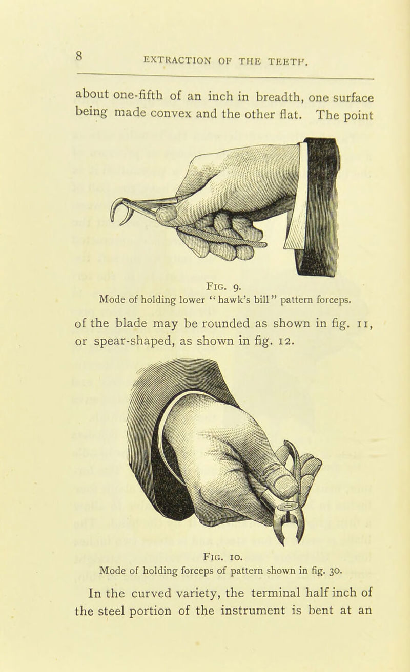 EXTRACTION OF THE TEETH. about one-fifth of an inch in breadth, one surface being made convex and the other flat. The point Fig. 9. Mode of holding lower  hawk's bill pattern forceps. of the blade may be rounded as shown in fig. 11, or spear-shaped, as shown in fig. 12. Fig. 10. Mode of holding forceps of pattern shown in fig. 30. In the curved variety, the terminal half inch of the steel portion of the instrument is bent at an