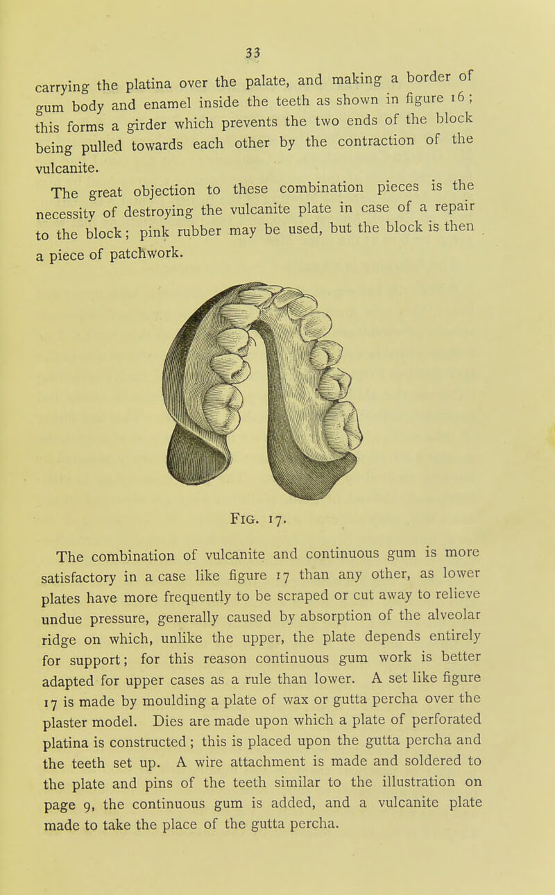 carrying the platina over the palate, and making a border of gum body and enamel inside the teeth as shown in figure i6; this forms a girder which prevents the two ends of the block being pulled towards each other by the contraction of the vulcanite. The great objection to these combination pieces is the necessity of destroying the vulcanite plate in case of a repair to the block; pink rubber may be used, but the block is then a piece of patchwork. Fig. 17. The combination of vulcanite and continuous gum is more satisfactory in a case like figure 17 than any other, as lower plates have more frequently to be scraped or cut away to relieve undue pressure, generally caused by absorption of the alveolar ridge on which, unlike the upper, the plate depends entirely for support; for this reason continuous gum work is better adapted for upper cases as a rule than lower. A set like figure 17 is made by moulding a plate of wax or gutta percha over the plaster model. Dies are made upon which a plate of perforated platina is constructed ; this is placed upon the gutta percha and the teeth set up. A wire attachment is made and soldered to the plate and pins of the teeth similar to the illustration on page 9, the continuous gum is added, and a vulcanite plate made to take the place of the gutta percha.