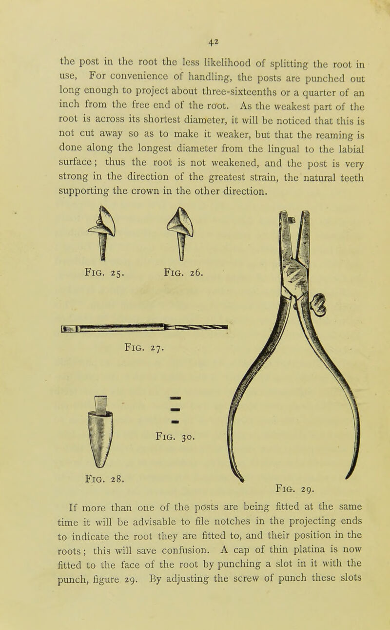 the post in the root the less likelihood of splitting the root in use, For convenience of handling, the posts are punched out long enough to project about three-sixteenths or a quarter of an inch from the free end of the root. As the weakest part of the root is across its shortest diameter, it will be noticed that this is not cut away so as to make it weaker, but that the reaming is done along the longest diameter from the lingual to the labial surface; thus the root is not weakened, and the post is very strong in the direction of the greatest strain, the natural teeth supporting the crown in the other direction. If more than one of the posts are being fitted at the same time it will be advisable to file notches in the projecting ends to indicate the root they are fitted to, and their position in the roots; this will save confusion. A cap of thin platina is now fitted to the face of the root by punching a slot in it with the punch, figure 29. By adjusting the screw of punch these slots