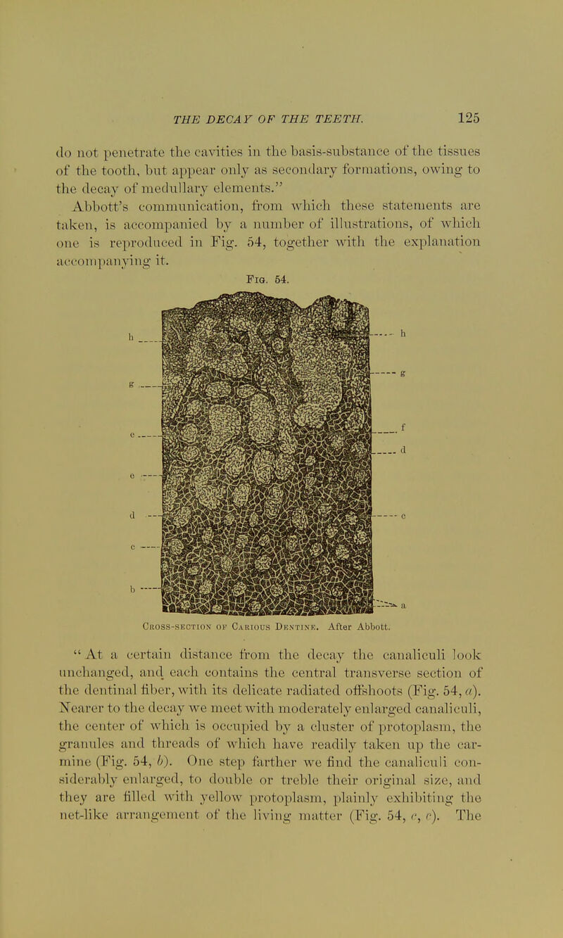 do not penetrate the cavities in the basis-substance of the tissues of the tooth, but appear only as secondary formations, owing to the decay of medullary elements. Abbott's communication, from which these statements are taken, is accompanied by a number of illustrations, of which one is reproduced in Fig. 54, together with the explanation accompanying it. Fig. 54. Cross-section of Carious Dentine. After Abbott. At a certain distance from the decay the canaliculi look unchanged, and each contains the central transverse section of the dentinal fiber, with its delicate radiated offshoots (Fig. 54, a). Nearer to the decay we meet with moderately enlarged canaliculi, the center of which is occupied by a cluster of protoplasm, the granules and threads of which have readily taken up the car- mine (Fig. 54, b). One step farther we find the canaliculi con- siderably enlarged, to double or treble their original size, and they are filled with yellow protoplasm, plainly exhibiting the nei-like arrangement of the living matter (Fig. 54, e, c). The