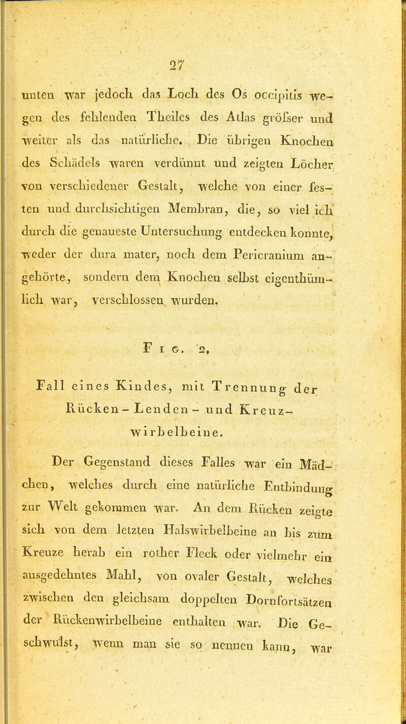 uuieu /war jedoch das Loch des Os occipitis we- gen des fehlendea Theiles des Alias gröfser und weiter als das nalürlictc. Die übrigen Knochen des Schädels waren verdiimit und zeigten Löcher, von verschiedener Gestalt, welche von einer fes- ten und durchsichtigen Membran, die, so viel ich durch die genaueste Untersuchung entdecken konnte, weder der dvn-a mater, noch dem Pericranium an- gehörte, sondern dem Knochen selbst eigenthüra- lich. war, verschlossen wurdein. Fig. 2, Fall eines Kindes, mit Trennung der Rücken - Lenden - und Kreuz- wirbelbeine. Der Gegenstand dieses Falles war ein Mäd- chen, welches durch eine natürliche Entbindung zur Welt gekommen war. An dem Rücken zeigte sich von dem letzten Halswirbelbeine an bis ztim Kreuze herab ein rother Fleck oder vielmehr ein ausgedehntes Mahl, von ovaler Gestalt, welches zwischen den gleichsam doppellen Dornfortsälzen der Rückenwirbelbeine enthalten war. Die Ge- sclwülst, Wenn man sie so nennen kann, war