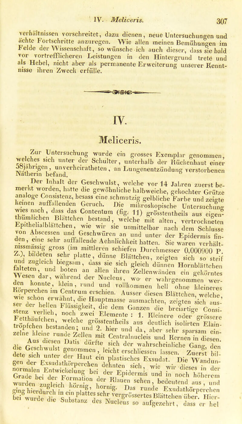 IV. Meliceris. verhiilmissen vorschreitet, dazu dienen, neue Untersuchungen und ächte Fortschritte anzuregen. Wie allen meinen Bemühungen im Felde der Wissenschaft, so wünsche ich auch dieser, dass sie bald vor vortrefflicheren Leistungen in den Hintergrund tretö und als Hebel, nicht aber als permanente Erweiterung unserer Kennt- nisse ihren Zweck erfülle. IV. Meliceris. Zur Untersuchung wurde ein grosses Exemplar genommen, welches sich unter der Schulter, unterhalb der Rückenhaut einer ööjabrigen , unverheiratheten , an Lungenentzündung verstorbenen JNathenn befand. Der Inhalt der Geschwulst, welche vor 14 Jahren zuerst be- merkt worden, hatte die gewöhnliche halbweiche, gekochter Grütze analoge Consistenz, besass eine schmutzig gelbliehe Farbe und zeigte kernen auffallenden Geruch. Die mikroskopische Untersuchung wies nach, dass das Contenlum (fig.- 11) grösstentheils aus eigen- Fn-Sr fK^-^ f'^'-''''*''^'.^''^^ »^^ «'f^' vertrockneten EpUhehalblattchen wie wn- sie unmittelbar nach dem Schlüsse von Abscessen und Geschwüren an und unter der Epidermis fin- den, eine sehr auffallende Aehnlichkeit hatten. Sie waren verhält nissmassig gross (im mittleren schiefen Durchmesser 0,000900 P Z^) bildeten sehr platte dünne Blättchen, zeigten sid. so steif faketen^ niN^IT'' -^'^ ^'^'^^ Hornblättchen falteten und boten an allen ihren Zellenwänden ein gekörntes Wesen dar, wahrend der Nucleus, wo- er wahrgenommen wer- den konnte, klein, rund und vollkommen hell ohne kleineres Kurperchen im Centrum erschien. Ausser diesen Blättchen, welche wie schon erwähnt, die Hauptmasse ausmachten, zeigten sidi aus' ser der hellen Flüssigkeit, die dem Ganzen die' breiartige Göns  Feuh'fr^' noch zwei Elemente : 1. Kleinere oder^rüssere Fetthaufchen, welche grösstentheils aus deutlich isolirten Sn tropfchen bestanden; und 2. hier und da, aber sehr sparsanT e n zelne kleine runde Zellen mit Centralnuclds und Kerne'^ in Lsen' die cZ^ T ^^'^'^ '^^ wahrscheinliche Gang den