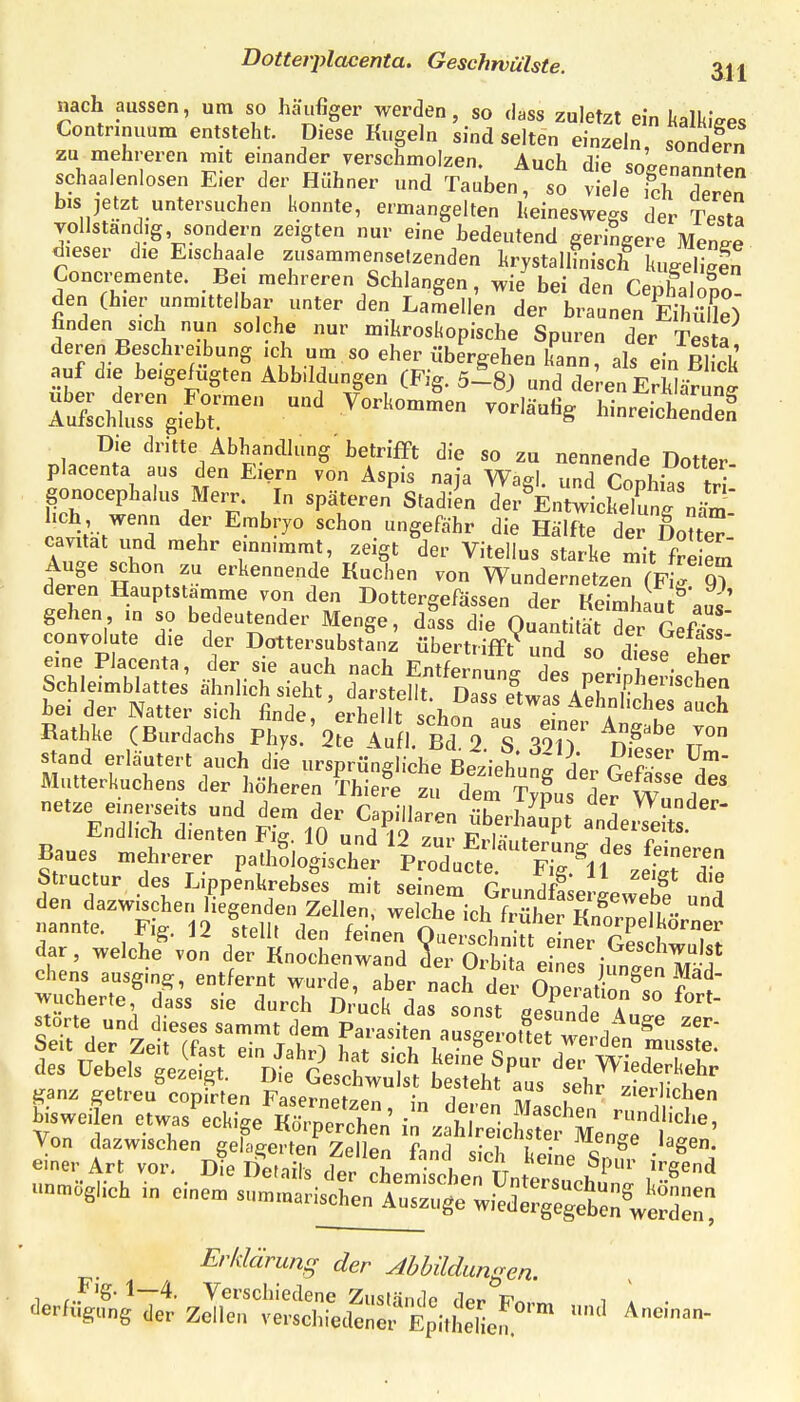 nach aussen, um so häufiger werden, so dass zuletzt ein ItalkJees Contnnuum entsteht. Diese Kugeln sind selten einzeln, sondfrn zu mehreren mit einander yerschmolzen. Auch die sogenannten schaaienlosen E:er der Hühner und Tauben, so viele fch deren bis jetzt untersuchen konnte, ermangelten heineswegs der Testa vollstanCg, sondern zeigten nur eine bedeutend geringere MenZ dieser die E.schaale zusammensetzenden lirystallhiisch luJeS Concremente. Bei mehreren Schlangen, wie bei den Cephairo- den (hier unmittelbar unter den Lamellen der braunen EiSe) finden sich nun solche nur mikroskopische Spuren der Testa deren Beschreibung idi um so eher übergehen kann, als ein ß ck auf die beigefugten Abbildungen (Fig. und deren ErWärun^ ltlht:gifbr^ -^'^-^ l-reichS gonocephalus Merr. In späteren'Stadi^en del-^kZlckeTunrnäm- ^llJ A ^T ^^^-^'^ S^^^'^^ Hälfte der DoUe^. cavitat und mehr emn.mmt, zeigt der Vitellus starke mit fre em derfn H l T- ^^^«^f von Wundernetzen (p l gT deren Hauptstamme von den Dottergefässen der Keimhau^aus gehen in so bedeutender Menge, dass die Quantität der Qefö - convolute die der Dottersubstanz übertrifft^ und so dTese eher' eine Placenta, der sie auch nach Entfernung des peripherischpn b'et'der S^r tT^^ ^ ^^1^^^'' ^f^^ Rathke (Burdachs Phys!'2 d^ ^and erläutert auch die ursprüngliche t^-etufL GSe^'d':; Mutterkuchens der höheren Thiere zu dem TvSus dpr W i netze einerseits und dem der Capillaren überSp andeS Endlich dienten Fig. 10 und 12 7nv t^iseits. Baues „eh,.e..r paU^^lo^thet vZ^^'X^l'^TlS, Structnr des I.ippenlirebses mit seinem GrundfSeiiewS j dar, welche^„„ i^'LtlotZi tl'o^ 17^^Zf^^^ chens ausging, entfern, wurde, aber nach dei Opera iö^»; Seit der Zei fastTi^ lS p''''»j/»g-01tet werden musste. des üebels Ve.<:St  D^^äi^Ts eTh Ts 'Z^^ 4-anz getreu copirten Fasernetzen In aZZ m u ^'^»^'^hen bisweilen etwas'eckige Körprcrn^ ^zaU^e cS'Slnr^^^ Von dazwischen gelagerten Zellen fand sich keine Sn^ • einer Art vor. Die Details der chemlchen UntPrc f ^/'^'^ unmöglich in einem summariscÄute^^^^ Erklärung der Abbildungen. 1 r..^'S- 1—4. Verschiedene Zustände der Fnnrv, i \ ■ Verfügung der Zellen verschiedener ^itSe^ '^