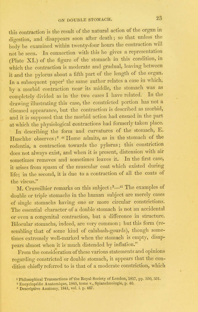 this contraction is the result of the natural action of the organ in digestion, and disappears soon after death; so that unless the body be examined within twenty-four hours the contraction will not be seen. In connection with this he gives a representation (Plate XI.) of the figure of the stomach in this condition, in which the contraction is moderate and gradual, leaving between it and the pylorus about a fifth part of the length of the organ. In a subsequent paper1 the same author relates a case in which, by a morbid contraction near its middle, the stomach was as completely divided as in the two cases I have related. In the drawing illustrating this case, the constricted portion has not a diseased appearance, but the contraction is described as morbid, and it is supposed that the morbid action had ensued in the part at which the physiological contractions had formerly taken place. In describing the form and curvatures of the stomach, E. Huschke observes:2 Home admits, as in the stomach of the rodentia, a contraction towards the pylorus; this constriction does not always exist, and when it is present, distension with air sometimes removes and sometimes leaves it. In the first case, it arises from spasm of the muscular coat which existed during life; in the second, it is due to a contraction of all the coats of the viscus. M. Cruveilhier remarks on this subject:3— The examples of double or triple stomachs in the human subject are merely cases of single stomachs having one or more circular constrictions. The essential character of a double stomach is not an accidental or even a congenital contraction, but a difference in structure. Bilocular stomachs, indeed, are very common ; but this form (re- sembling that of some kind of calabash-gourds), though some- times extremely well-marked when the stomach is empty, disap- pears almost when it is much distended by inflation. From the consideration of these various statements and opinions regarding constricted or double stomach, it appears that the con- dition chiefly referred to is that of a moderate constriction, which 1 Philosophical Transactions of the Royal Society of London, 1817, pp. 360, 351. 2 Encyclopedic Anatomique, 1845, tome v., Splanchnologie, p. 46. 3 Descriptive Anatomy, 1841, vol. i. p. 467.