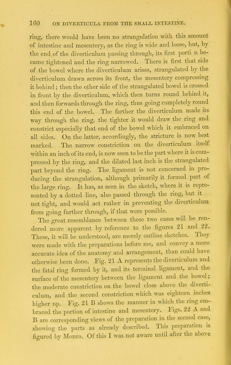 ring, there would have been no strangulation with this amount of intestine and mesentery, as the ring is wide and loose, but, by the end of the diverticulum passing through, its first porti n be- came tightened and the ring narrowed. There is first that side of the bowel where the diverticulum arises, strangulated by the diverticulum drawn across its front, the mesentery compressing it behind; then the other side of the strangulated bowel is crossed in front by the diverticulum, which then turns round behind it, and then forwards through the ring, thus going completely round this end of the bowel. The farther the diverticulum made its way through the ring, the tighter it would draw the ring and constrict especially that end of the bowel which it embraced on all sides. On the latter, accordingly, the stricture is now best marked. The narrow constriction on the diverticulum itself within an inch of its end, is now seen to be the part where it is com- pressed by the ring, and the dilated last inch is the strangulated part beyond the ring. The ligament is not concerned in pro- ducing the strangulation, although primarily it formed part of the large ring. It has, as seen in the sketch, where it is repre- sented by a dotted line, also passed through the ring, but it not tight, and would act rather in preventing the diverticulum from going further through, if that were possible. The great resemblance between these two cases will be ren- dered more apparent by reference to the figures 21 and 22. These, it will be understood, are merely outline sketches. They were made with the preparations before me, and convey a more accurate idea of the anatomy and arrangement, than could have otherwise been done. Fig. 21 A represents the diverticulum and the fatal ring formed by it, and its terminal ligament, and the surface of the mesentery between the ligament and the bowel ] the moderate constriction on the bowel close above the diverti- culum, and the second constriction which was eighteen inches higher up. Fig. 21 B shows the manner in which the ring em- braced the portion of intestine and mesentery. Figs. 22 A and B are corresponding views of the preparation in the second case, showing the parts as already described. This preparation is figured by Monro. Of this I was not aware until after the above