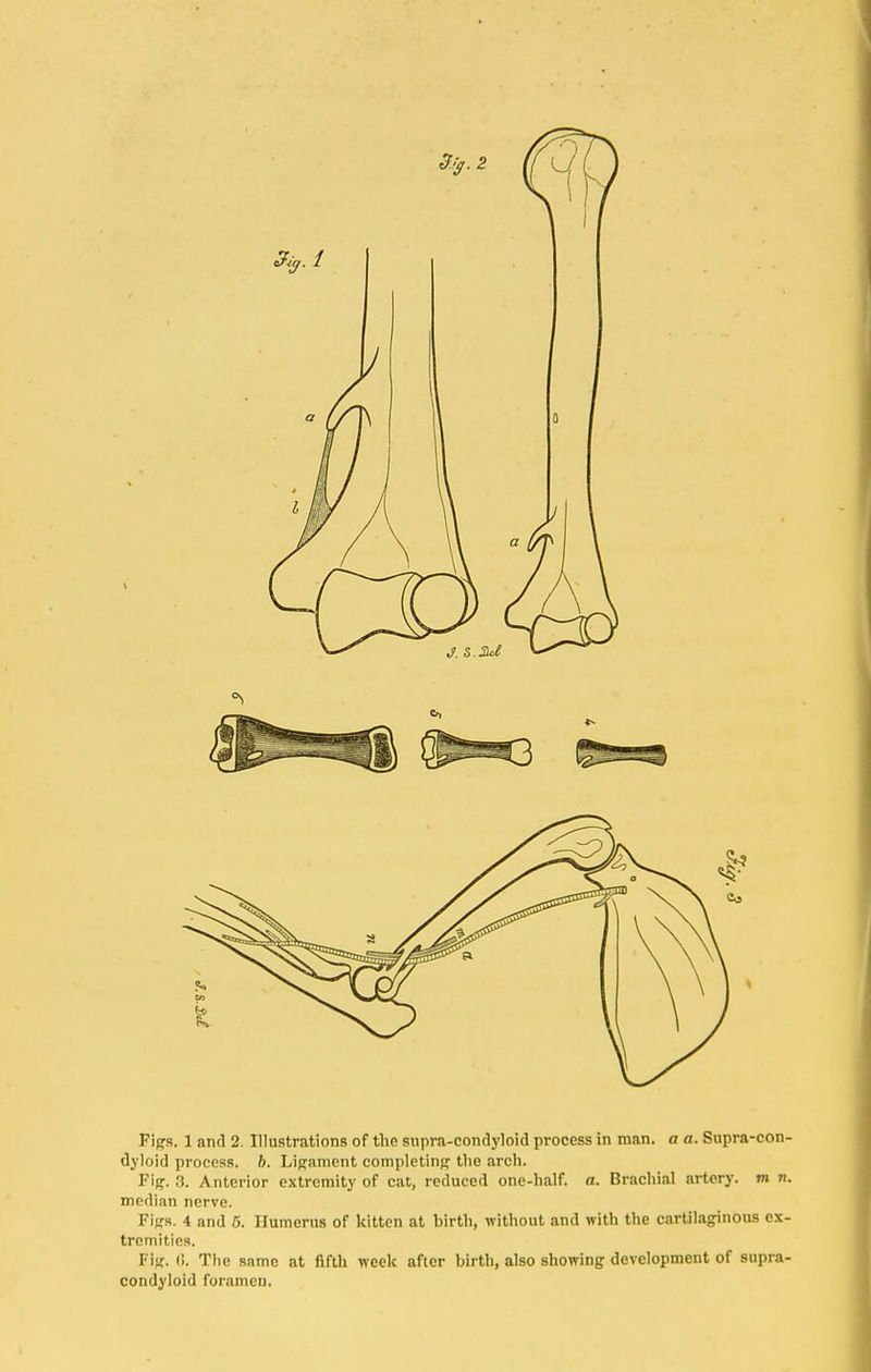 dyloid process. 6. Ligament completing the .arch. Fig. 3. Anterior extremity of cat, reduced one-half. a. Brachial artery, m n. median nerve. Figs. 4 and 5. Humerus of kitten at birth, without and with the cartilaginous ex- tremities. Fig. li. The same at fifth week after birth, also showing development of supra- condyloid foramen.