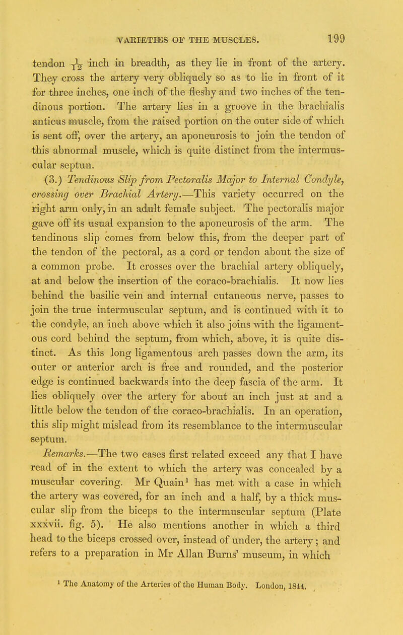 tendon j1^ inch in breadth, as they lie in front of the artery. They cross the artery very obliquely so as to lie in front of it for three inches, one inch of the fleshy and two inches of the ten- dinous portion. The artery lies in a groove in the brachialis anticus muscle, from the raised portion on the outer side of which is sent off, over the artery, an aponeurosis to join the tendon of this abnormal muscle, which is quite distinct from the intermus- cular septun. (3.) Tendinous Slip from Pectoralis Major to Internal Condyle, crossing over Brachial Artery.—This variety occurred on the right arm only, in an adult female subject. The pectoralis major gave off its usual expansion to the aponeurosis of the arm. The tendinous slip comes from below this, from the deeper part of the tendon of the pectoral, as a cord or tendon about the size of a common probe. It crosses over the brachial artery obliquely, at and below the insertion of the coraco-brachialis. It now lies behind the basilic vein and internal cutaneous nerve, passes to join the true intermuscular septum, and is continued with it to the condyle, an inch above which it also joins with the ligament- ous cord behind the septum, from which, above, it is quite dis- tinct. As this long ligamentous arch passes down the arm, its outer or anterior arch is free and rounded, and the posterior edge is continued backwards into the deep fascia of the arm. It lies obliquely over the artery for about an inch just at and a little below the tendon of the coraco-brachialis. In an operation, this slip might mislead from its resemblance to the intermuscular septum. Remarks.—The two cases first related exceed any that I have read of in the extent to which the artery was concealed by a muscular covering. Mr Quain1 has met with a case in which the artery was covered, for an inch and a half, by a thick mus- cular slip from the biceps to the intermuscular septum (Plate xxxvii. fig. 5). He also mentions another in which a third head to the biceps crossed over, instead of under, the artery; and refers to a preparation in Mr Allan Burns' museum, in which 1 The Anatomy of the Arteries of the Human Body. London, 1844.