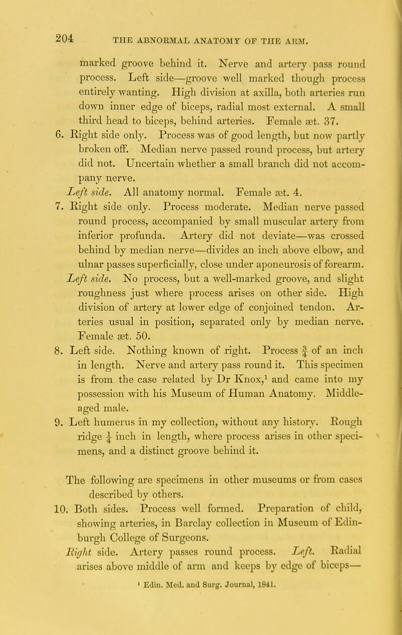marked groove behind it. Nerve and artery pass round process. Left side—groove well marked though process entirely wanting. High division at axilla, both arteries run down inner edge of biceps, radial most external. A small third head to biceps, behind arteries. Female set. 37. 6. Right side only. Process was of good length, but now partly broken off. Median nerve passed round process, but artery did not. Uncertain whether a small branch did not accom- pany nerve. Left side. All anatomy normal. Female ast. 4. 7. Eight side only. Process moderate. Median nerve passed round process, accompanied by small muscular artery from inferior profunda. Artery did not deviate—was crossed behind by median nerve—divides an inch above elbow, and ulnar passes superficially, close under aponeurosis of forearm. Left side. No process, but a well-marked groove, and slight roughness just where process arises on other side. High division of artery at lower edge of conjoined tendon. Ar- teries usual in position, separated only by median nerve. Female set. 50. 8. Left side. Nothing known of right. Process f of an inch in length. Nerve and artery pass round it. This specimen is from the case related by Dr Knox,1 and came into my possession with his Museum of Human Anatomy. Middle- aged male. 9. Left humerus in my collection, without any history. Rough ridge ^ inch in length, where process arises in other speci- mens, and a distinct groove behind it. The following are specimens in other museums or from cases described by others. 10. Both sides. Process well formed. Preparation of child, showing arteries, in Barclay collection in Museum of Edin- burgh College of Surgeons. Right side. Artery passes round process. Left. Radial arises above middle of arm and keeps by edge of biceps— 1 Edin. Med. and Surg. Journal, 1841.