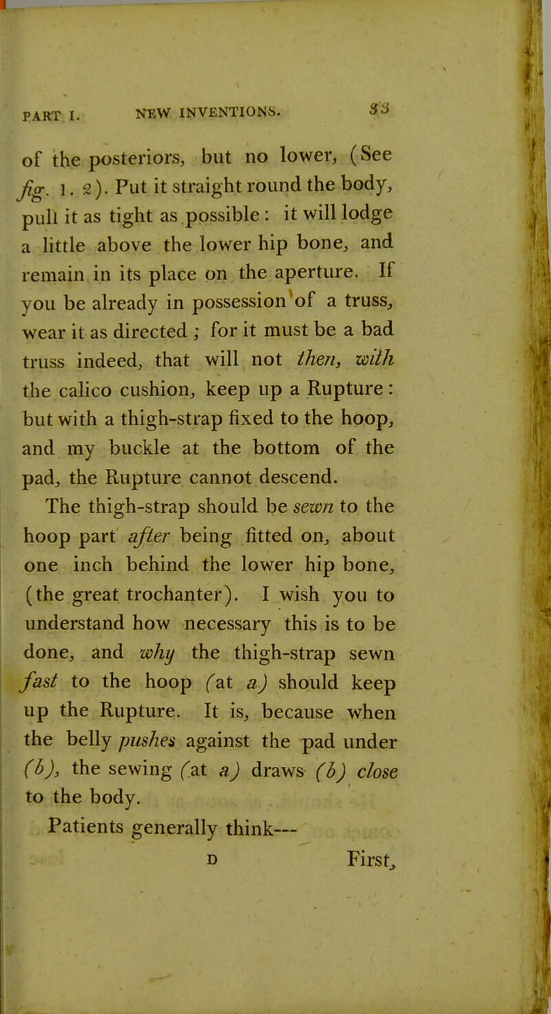of the posteriors, but no lower, (See fg. 1.2). Put it straight round the body, pull it as tight as possible : it will lodge a little above the lower hip bone, and remain in its place on the aperture. If you be already in possession*of a truss, wear it as directed ; for it must be a bad truss indeed, that will not then, with the calico cushion, keep up a Rupture: but with a thigh-strap fixed to the hoop, and my buckle at the bottom of the pad, the Rupture cannot descend. The thigh-strap should be sewn to the hoop part after being fitted on, about one inch behind the lower hip bone, (the great trochanter). I wish you to understand how necessary this is to be done, and why the thigh-strap sewn fast to the hoop (at a) should keep up the Rupture. It is, because when the belly pushes against the pad under (b), the sewing (at a) draws (b) close to the body. Patients generally think— D Firsts