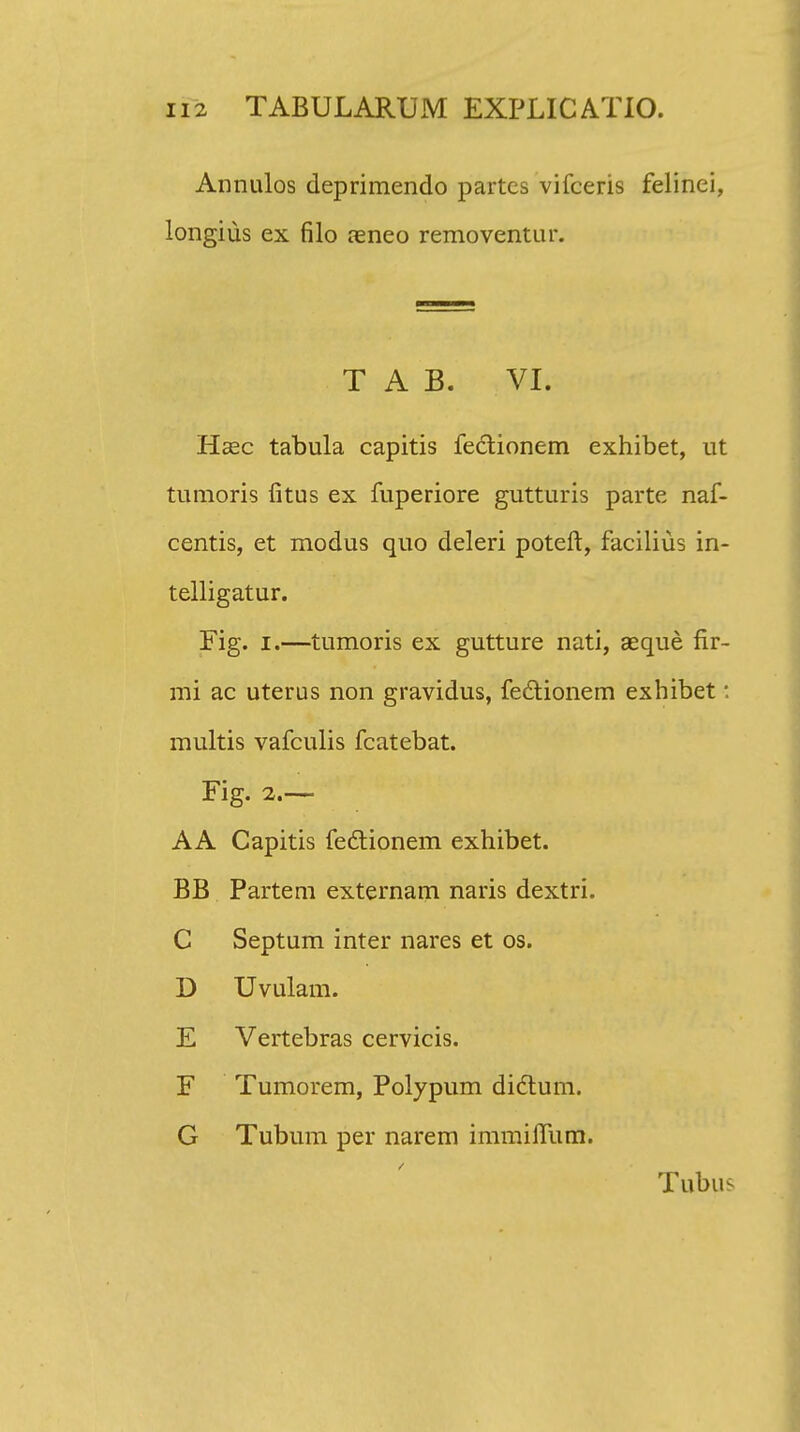 Annulos deprimendo partes vifceris felinei, longius ex filo aeneo removentur. T A B. VI. Haec tabula capitis feclionem exhibet, ut tumoris fitus ex fuperiore gutturis parte naf- centis, et modus quo deleri poteft, facilius in- telligatur. Fig. i.—tumoris ex gutture nati, aeque fir- mi ac uterus non gravidus, fectionem exhibet: multis vafculis fcatebat. Fig. 2.— AA Capitis fectionem exhibet. BB Partem externam naris dextri. C Septum inter nares et os. D Uvulam. E Vertebras cervicis. F Tumorem, Polypum didtum. G Tubum per narem immifTum. Tubu^