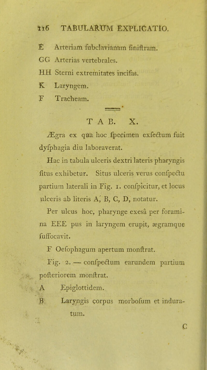 £ Arteriam fubclavianam finiftram. GG Artcrias vertebrales. HH Sterni extremitates incifas. K Laryngem. F Tracheam. T A B. X. iEgra ex qiia hoc fpecimen exfe&um fuit dyfphagia diu laboraverat. Hac in tabula ulceris dextri lateris pharyngis litus exhibetur. Situs ulceris verus confpeclu partium laterali in Fig. i. confpicitur, et locus ulceris ab literis A,' B, C, D, notatur. Per ulcus hoc, pharynge exesa per forami- na EEE pus in laryngem erupit, segramque fuffocavit. F Oefophagum apertum monftrat. Fig. 2. — confpedtum earundem partium pofteriorem monftrat. A Epiglottidem. B Laryngis corpus morbofum et indura- tum.