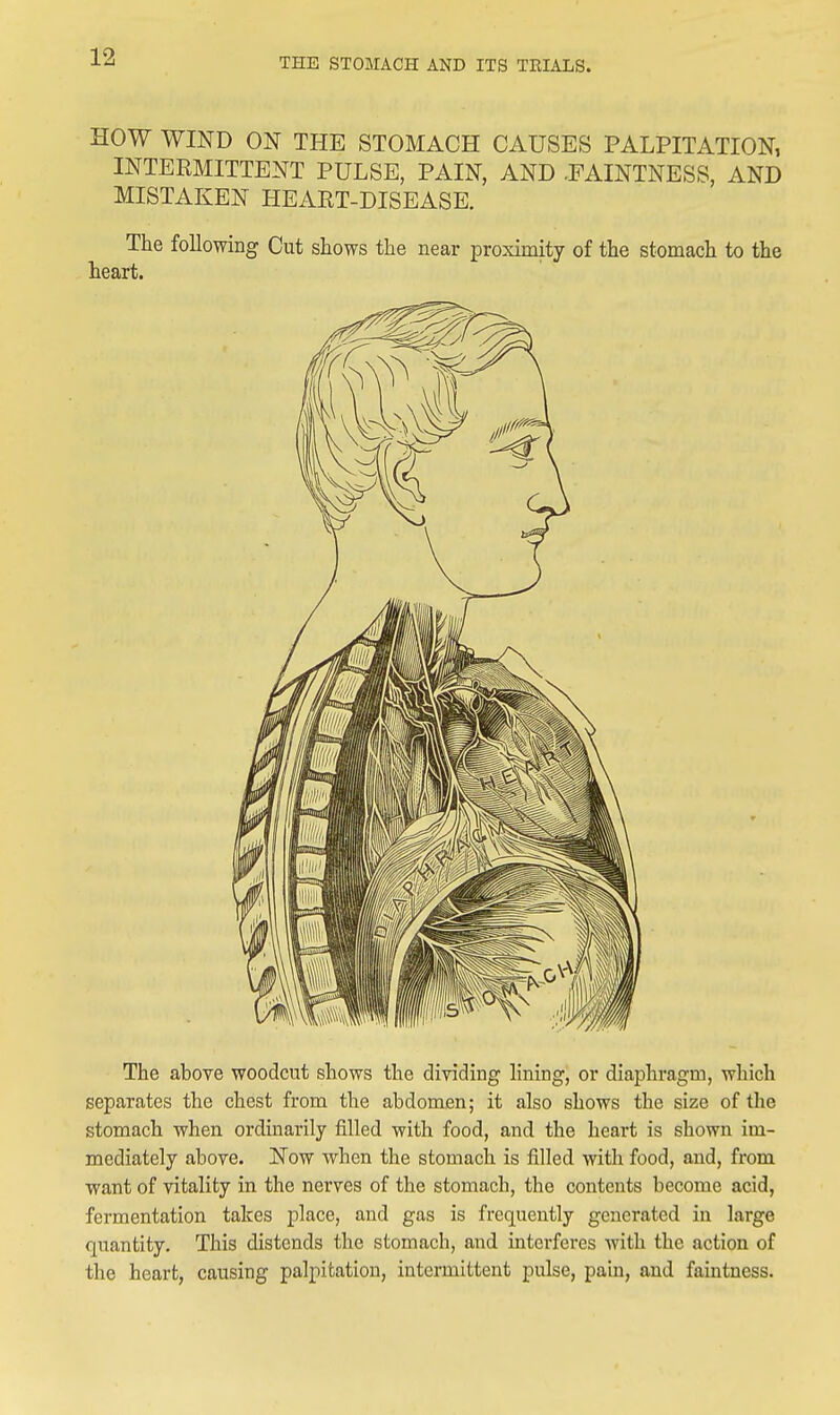 HOW WIND ON THE STOMACH CAUSES PALPITATION, INTERMITTENT PULSE, PAIN, AND .FAINTNESS, AND MISTAKEN HEART-DISEASE. The following Cut shows the near proximity of the stomach to the heart. The above woodcut shows the dividing lining, or diaphragm, which separates the chest from the abdomen; it also shows the size of the stomach when ordinarily filled with food, and the heart is shown im- mediately above. Now when the stomach is filled with food, and, from want of vitality in the nerves of the stomach, the contents become acid, fermentation takes place, and gas is frequently generated in large quantity. This distends the stomach, and interferes with the action of the heart, causing palpitation, intermittent pulse, pain, and faintncss.