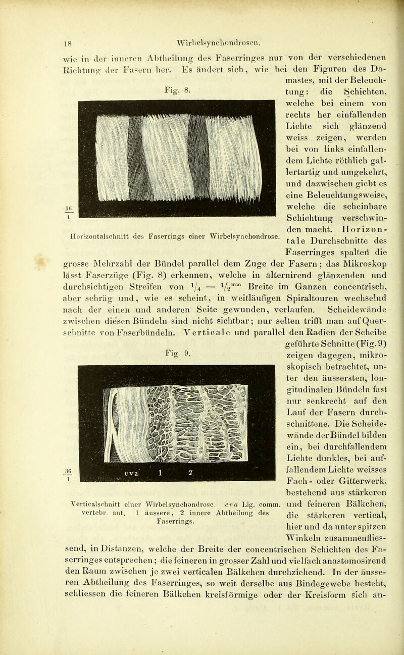 Hovizoiitalschnitt des Faserrings einer Wirbelsynchondrose. wie in der inneren Abtheilung des Faserringes nur von der verschiedenen Richtung der Fasern lier. E.s ändert sich, wie bei den Figuren des Da- mastes, mit der Beleuch- J^ig- 8. tung: die Schichten, welche bei einem von rechts her einfallenden Lichte sich glänzend weiss zeigen, werden bei von links einfallen- dem Lichte röthlich gal- lertartig und umgekehrt, und dazwischen giebt es eine Beleuchtungsweise, welche die scheinbare Schichtung verschwin- den macht. Horizon- tale Durchschnitte des Faserringes spalteil die grosse Melirzahl der Bündel parallel dem Zuge der Fasern ; das Mikroskop lässt Faserzüge (Fig. 8) erkennen, welche in alternirend glänzenden und durchsichtigen Streifen von — V2 Breite im Ganzen concentrisch, aber schräg und, wie es scheint, in weitläufigen Spiraltouren wechselnd nach der einen und anderen Seite gewunden, verlaufen. Scheidewände zwischen diesen Bündeln sind nicht sichtbar; nur selten trifft man auf Quer- schnitte von Faserbündeln. Verticale imd parallel den Radien der Scheibe geführte Schnitte (Fig. 9) ^'S 9- zeigen dagegen, mikro- skopisch betrachtet, un- ter den äussersten, lon- gitndinalen Bündeln fast nur senkrecht auf den Lauf der Fasern durch- schnittene. Die Scheide- wände der Bündel bilden ein, bei durchfallendem Lichte dunkles, bei auf- fallendem Lichte weisses Fach - oder Gitterwerk, bestehend aus stärkeren und feineren Bälkchen, die stärkeren vertical, hier und da unter spitzen Winkeln zusammenflies- send, in Distanzen, welche der Breite der concentrischen Schichten des Fa- serringes entsprechen; die feineren in grosser Zahl und viellach anastomosirend den Raum zwischen je zwei verticalen Bälkchen durchziehend. In der äusse- ren Abtheilung des Faserringes, so weit derselbe aus Bindegewebe besteht, schliessen die feineren Bälkchen kreisförmige oder der Kreisform sich an- Verticalschnitt einer Wirbelsynchondrose- ci-a Lig. coinm. vertebr. ant. 1 äussere, 2 innere Abtiieilung des Faserrings.
