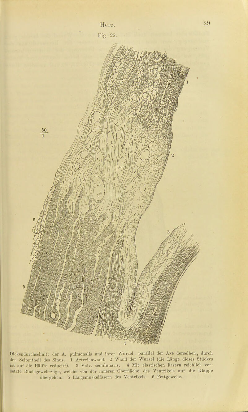 Fig. 22. Bickendurciisrhnitt der A. pulmonalis und ihrer Wurzel, parallel der Axe derselben, durch den Seitentheil des Sinus. 1 Arterienwand. 2 Wand der Wurzel (die Länge dieses Stückes ist auf die Hälfte reducirt). 3 Valv. semilunaris. 4 Mit elastischen Fasern reichlich ver- setzte Bindegewebszüge, welche von der inneren Oberfläche des Ventrikels auf die Klappe übergehen. 5 Längsmuskelfasern des Ventrikels. 6 Fettgewebe.