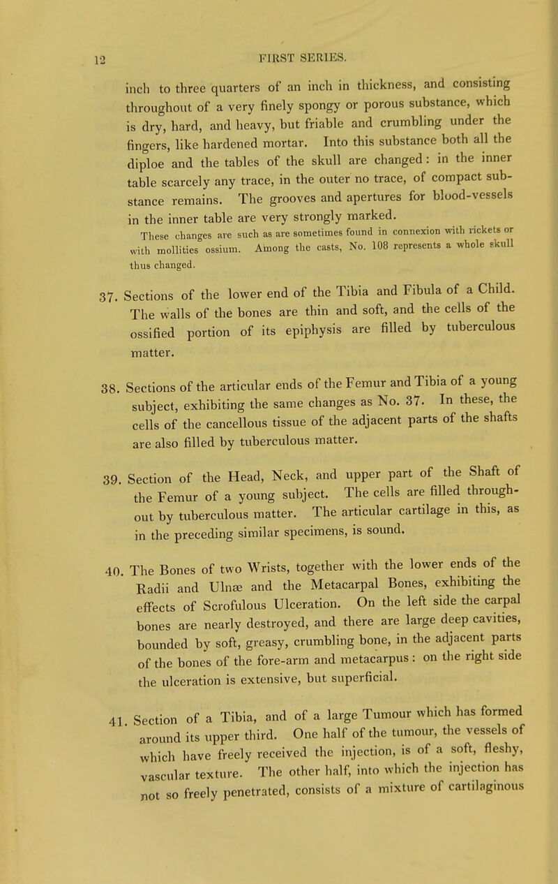 inch to three quarters of an inch in thickness, and consisting throughout of a very finely spongy or porous substance, which is dry, hard, and heavy, but friable and crumbling under the fingers, like hardened mortar. Into this substance both all the diploe and the tables of the skull are changed: in the inner table scarcely any trace, in the outer no trace, of compact sub- stance remains. The grooves and apertures for blood-vessels in the inner table are very strongly marked. These changes are such as are sometimes found in connexion with rickets or with mollities ossium. Among the casts, No. 108 represents a whole skull thus changed. 37. Sections of the lower end of the Tibia and Fibula of a Child. The walls of the bones are thin and soft, and the cells of the ossified portion of its epiphysis are filled by tuberculous matter. 38. Sections of the articular ends of the Femur and Tibia of a young subject, exhibiting the same changes as No. 37. In these, the cells of the cancellous tissue of the adjacent parts of the shafts are also filled by tuberculous matter. 39. Section of the Head, Neck, and upper part of the Shaft of the Femur of a young subject. The cells are filled through- out by tuberculous matter. The articular cartilage in this, as in the preceding similar specimens, is sound. 40. The Bones of two Wrists, together with the lower ends of the Radii and Ulnae and the Metacarpal Bones, exhibiting the effects of Scrofulous Ulceration. On the left side the carpal bones are nearly destroyed, and there are large deep cavities, bounded by soft, greasy, crumbling bone, in the adjacent parts of the bones of the fore-arm and metacarpus : on the right side the ulceration is extensive, but superficial. 41 Section of a Tibia, and of a large Tumour which has formed around its upper third. One half of the tumour, the vessels of which have freely received the injection, is of a soft, fleshy, vascular texture. The other half, into which the injection has not so freely penetrated, consists of a mixture of cartilaginous