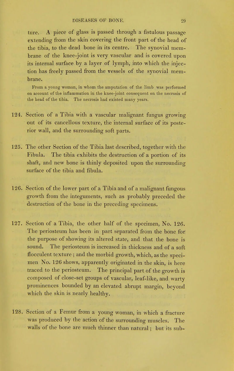 tiire. A piece of glass is passed through a fistulous passage extending from the skin covering the front part of the head of the tibia, to the dead bone in its centre. The synovial mem- brane of the knee-joint is very vascular and is covered upon its internal surface by a layer of lymph, into which the injec- tion has freely passed from the vessels of the synovial mem- brane. From a young woman, in whom the amputation of the limb was performed on account of the inflammation in the knee-joint consequent on the necrosis of the head of the tibia. The necrosis had existed many years. 124. Section of a Tibia with a vascular malignant fungus growing out of its cancellous texture, the internal surface of its poste- rior wall, and the surrounding soft parts. 125. The other Section of the Tibia last described, together with the Fibula. The tibia exhibits the destruction of a portion of its shaft, and new bone is thinly deposited upon the surrounding surface of the tibia and fibula. 126. Section of the lower part of a Tibia and of a malignant fungous growth from the integuments, such as probably preceded the destruction of the bone in the preceding specimens. 127. Section of a Tibia, the other half of the specimen, No. 126. The periosteum has been in part separated from the bone for the purpose of showing its altered state, and that the bone is sound. The periosteum is increased in thickness and of a soft flocculent texture ; and the morbid growth, which, as the speci- men No. 126 shows, apparently originated in the skin, is here traced to the periosteum. The principal part of the growth is composed of close-set groups of vascular, leaf-like, and warty prominences bounded by an elevated abrupt margin, beyond which the skin is nearly healthy. 128. Section of a Femur from a young woman, in which a fracture was produced by the action of the surrounding muscles. The walls of the bone are much thinner than natural; but its sub-