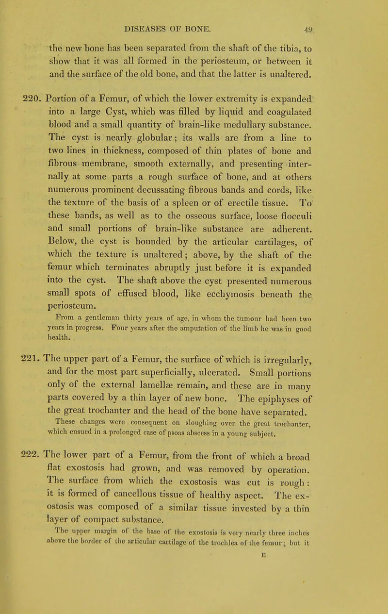 the new bone has been separated from the shaft of the tibia, to show that it was all formed in the periosteum, or between it and the surface of the old bone, and that the latter is unaltered. 220. Portion of a Femur, of which the lower extremity is expanded into a large Cyst, which was filled by liquid and coagulated blood and a small quantity of brain-like medullary substance. The cyst is nearly globular; its walls are from a line to two lines in thickness, composed of thin plates of bone and fibrous membrane, smooth externally, and presenting inter- nally at some parts a rough surface of bone, and at others numerous prominent decussating fibrous bands and cords, like the texture of the basis of a spleen or of erectile tissue. To these bands, as well as to the osseous surface, loose flocculi and small portions of brain-like substance are adherent. Below, the cyst is bounded by the articular cartilages, of which the texture is unaltered; above, by the shaft of the femur which terminates abruptly just before it is expanded into the cyst. The shaft above the cyst presented numerous small spots of effused blood, like ecchymosis beneath the periosteum. From a gentleman thirty years of age, in whom the tumour had heen two years in progress. Four years after the amputation of the limb he was in good health. 221. The upper part of a Femur, the surface of which is irregularly, and for the most part superficially, ulcerated. Small portions only of the external lamellae remain, and these are in many parts covered by a thin layer of new bone. The epiphyses of the great trochanter and the head of the bone have separated. These changes were consequent on sloughing over the great trochanter, which ensued in a prolonged case of psoas abscess in a young subject. 222. The lower part of a Femur, from the front of which a broad flat exostosis had grown, and was removed by operation. The surface from which the exostosis was cut is rough : it is formed of cancellous tissue of healthy aspect. The ex- ostosis was composed of a similar tissue invested by a thin layer of compact substance. The upper margin of the base of the exostosis is very nearly three inches above the border of the articular cartilage of the trochlea of the femur; but it £