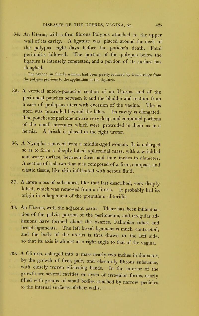 34. An Uterus, with a firm fibrous Polypus attached to the upper wall of its cavity. A ligature was placed around the neck of the polypus eight days before the patient's death. Fatal peritonitis followed. The portion of the polypus below the ligature is intensely congested, and a portion of its surface has sloughed. The patient, an elderly woman, had been greatly reduced by hemorrhage from the polypus previous to the application of the ligature. 35. A vertical antero-posterior section of an Uterus, and of the peritoneal pouches between it and the bladder and rectum, from a case of prolapsus uteri with eversion of the vagina. The os uteri was protruded beyond the labia. Its cavity is elongated. The pouches of peritoneum are very deep, and contained portions of the small intestines which were protruded in them as in a hernia. A bristle is placed in the right ureter. 36. A Nympha removed from a middle-aged woman. It is enlarged so as to form a deeply lobed spheroidal mass, with a wrinkled and warty surface, between three and four inches in diameter. A section of it shows that it is composed of a firm, compact, and elastic tissue, like skin infiltrated with serous fluid. 37. A large mass of substance, like that last described, very deeply lobed, which was removed from a clitoris. It probably had its origin in enlargement of the preputium clitoridis. 38. An Uterus, with the adjacent parts. There has been inflamma- tion of the pelvic portion of the peritoneum, and irregular ad- hesions have formed about the ovaries, Fallopian tubes, and broad ligaments. The left broad ligament is much contracted, and the body of the uterus is thus drawn to the left side, so that its axis is almost at a right angle to that of the vagina. 39. A Clitoris, enlarged into a mass nearly two inches in diameter, by the growth of firm, pale, and obscurely fibrous substance, with closely woven glistening bands. In the interior of the growth are several cavities or cysts of irregular forms, nearly filled with groups of small bodies attached by narrow pedicles to the internal surfaces of their walls.