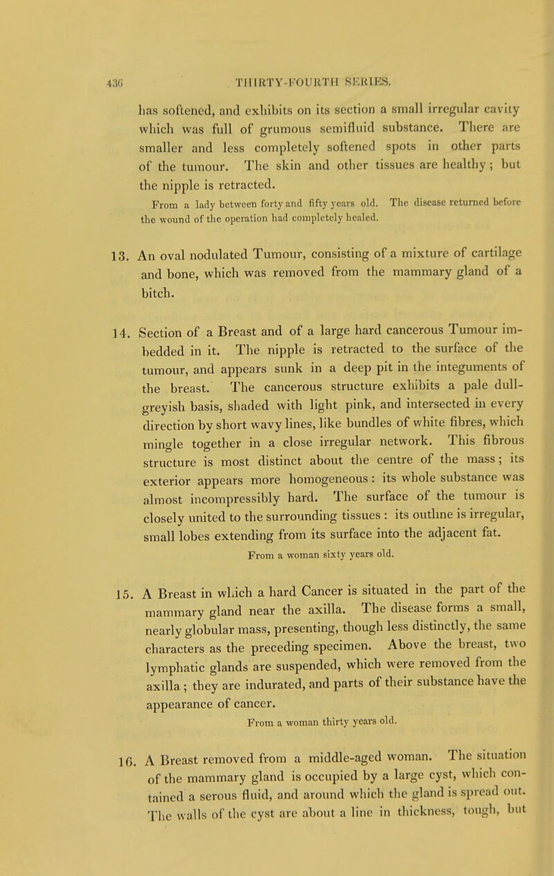 lias softened, and exhibits on its section a small irregular cavity which was full of grumous semifluid substance. There are smaller and less completely softened spots in other parts of the tumour. The skin and other tissues are healthy ; but the nipple is retracted. From a lady between forty and fifty years old. The disease returned before the wound of the operation had completely healed. 13. An oval nodulated Tumour, consisting of a mixture of cartilage and bone, which was removed from the mammary gland of a bitch. 14. Section of a Breast and of a large hard cancerous Tumour im- bedded in it. The nipple is retracted to the surface of the tumour, and appears sunk in a deep pit in the integuments of the breast. The cancerous structure exhibits a pale dull- greyish basis, shaded with light pink, and intersected in every direction by short wavy lines, like bundles of white fibres, which mingle together in a close irregular network. This fibrous structure is most distinct about the centre of the mass; its exterior appears more homogeneous: its whole substance was almost incompressibly hard. The surface of the tumour is closely united to the surrounding tissues : its outline is irregular, small lobes extending from its surface into the adjacent fat. From a woman sixty years old. 15. A Breast in which a hard Cancer is situated in the part of the mammary gland near the axilla. The disease forms a small, nearly globular mass, presenting, though less distinctly, the same characters as the preceding specimen. Above the breast, two lymphatic glands are suspended, which were removed from the axilla ; they are indurated, and parts of their substance have the appearance of cancer. From a woman thirty years old. 16. A Breast removed from a middle-aged woman. The situation of the mammary gland is occupied by a large cyst, which con- tained a serous fluid, and around which the gland is spread out. The walls of the cyst are about a line in thickness, tough, but