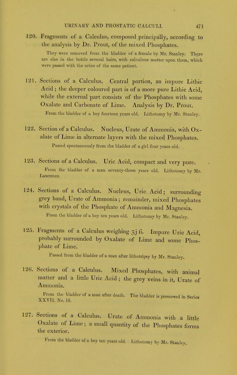 120. Fragments of a Calculus, composed principally, according to the analysis by Dr. Prout, of the mixed Phosphates. They were removed from the bladder of a female by Mr. Stanley. There are also in the bottle several hairs, with calculous matter upon them, which were passed with the urine of the same patient. 121. Sections of a Calculus. Central portion, an impure Lithic Acid ; the deeper coloured part is of a more pure Lithic Acid, while the external part consists of the Phosphates with some Oxalate and Carbonate of Lime. Analysis by Dr. Prout. From the bladder of a boy fourteen years old. Lithotomy by Mr. Stanley. 122. Section of a Calculus. Nucleus, Urate of Ammonia, with Ox- alate of Lime in alternate layers with the mixed Phosphates. Passed spontaneously from the bladder of a girl four years old. 123. Sections of a Calculus. Uric Acid, compact and very pure. From the bladder of a man seventy-three years old. Lithotomy by Mr. Lawrence. 124. Sections of a Calculus. Nucleus, Uric. Acid; surrounding grey band, Urate of Ammonia; remainder, mixed Phosphates with crystals of the Phosphate of Ammonia and Magnesia. From the bladder of a boy ten years old. Lithotomy by Mr. Stanley. 125. Fragments of a Calculus weighing jj fi. Impure Uric Acid, probably surrounded by Oxalate of Lime and some Phos- phate of Lime. Passed from the bladder of a man after lithotripsy by Mr. Stanley. 126. Sections of a Calculus. Mixed Phosphates, with animal matter and a little Uric Acid ; the grey veins in it, Urate of Ammonia. From the bladder of a man after death. The bladder is preserved in Series XXVII. No. 16. 127. Sections of a Calculus. Urate of Ammonia with a little Oxalate of Lime; a small quantity of the Phosphates forms the exterior. From the bladder of a boy ten years old. Lithotomy by Mr. Stanley.