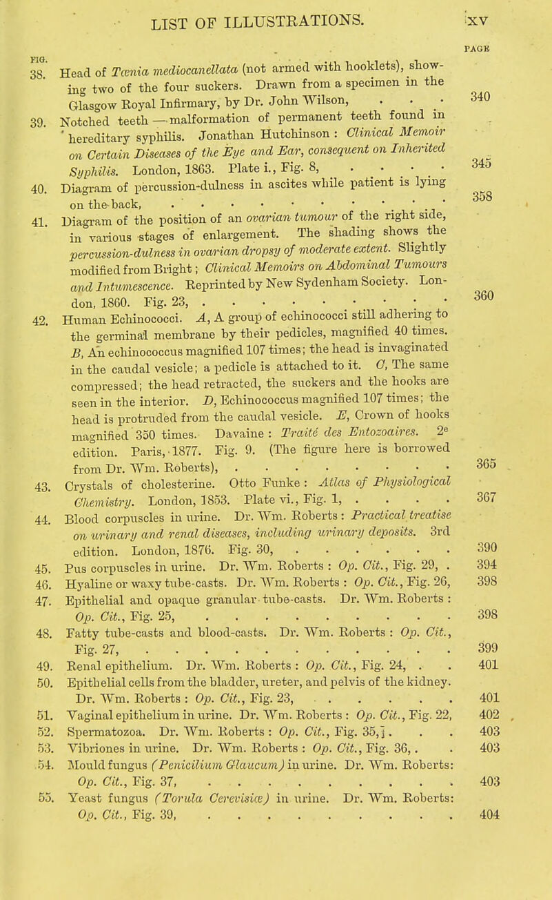 PACK FIO, 38. 340 358 360 Head of Tcenia mediocanellata (not armed with hooklets), show- ing two of the four suckers. Drawn from a specimen in the Glasgow Eoyal Infirmary, by Dr. John Wilson, . . _ • 39. Notched teeth — malformation of permanent teeth found m ' hereditary syphilis. Jonathan Hutchinson : ainical Memoir on Certain Diseases of the Eye and Ear, consequent on Inherited Si/philis. London, 1863. Plate i.. Fig. 8, . . . . 34o 40. Diagram of percussion-dulness in ascites while patient is lying on the-back, •  ' _ ' 41 Dia<Tam of the position of an ovarian tumour of the right side, in°various stages of enlargement. The shading shows the percussion-dulness in ovarian dropsy of moderate extent. SUghtly modified from Bright; Clinical Memoirs on Abdominal Tumours and Intumescence. Eeprinted by New Sydenham Society. Lon- don, 1860. Fig. 23, ; • 42. Human Echinococci. A, A group of echinococci still adhering to the germinal membrane by their pedicles, magnified 40 times. B, An echinococcus magnified 107 times; the head is invaginated in the caudal vesicle; a pedicle is attached to it. 0, The same compressed; the head retracted, the suckers and the hooks are seen in the interior. D, Echinococcus magnified 107 times; the head is protruded from the caudal vesicle. E, Crown of hooks magnified 350 times. Davaine : Trait6 des Entozoaires. 2« edition. Paris, 1877. Fig. 9. (The figure here is borrowed from Dr. Wm. Roberts), 43. Crystals of cholesterine. Otto Funke : Atlas of Physiological Chemistry. London, 1853. Plate vi., Fig. 1, .... 367 44. Blood corpuscles in urine. 'Dv.'Wm.'Rohexis: Practical treatise on urinary and renal diseases, including urinary deposits. 3rd edition. London, 1876. Fig. 30, . . . ' . . . 390 45. Pus corpuscles in urine. Dr. Wm. Roberts : Op. CiL, Fig. 29, . 394 46. Hyaline or waxy tube-casts. Dr. Wm. Roberts : Op. Cit., Fig. 26, 398 47. Epithelial and opaque granular tube-casts. Dr. AVm. Roberts : Op. at.. Fig. 25, 398 48. Fatty tube-casts and blood-casts. Dr. Wm. Roberts : Op. Cit., Fig. 27, 399 49. Renal epithelium. Dr. Wm. Roberts : Op. Ct'i., Fig. 24, . . 401 50. Epithelial cells from the bladder, ureter, and pelvis of the kidney. Dr. Wm. Roberts : Op. Cit., Fig. 23, 401 51. Vaginal epithelium in urine. Dr. Wm. Roberts : Op. Cit., Fig. 22, 402 .52. Spermatozoa. Dr. Wm. Roberts : Op. Cif., Fig. 35, j. . . 403 53. Vibriones in urine. Dr. Wm. Roberts : Op. Cit., Fig. 36,. . 403 .54. Mould fungus (PeniciliumGlaucum)i-o.-avi-aQ. Dr. Wm. Roberts: Op. at.. Fig. 37, 403 55. Yeast fungus (Torula CerevisiceJ in urine. Dr. Wm. Roberts: Op. at, Fig. 39, 404 365