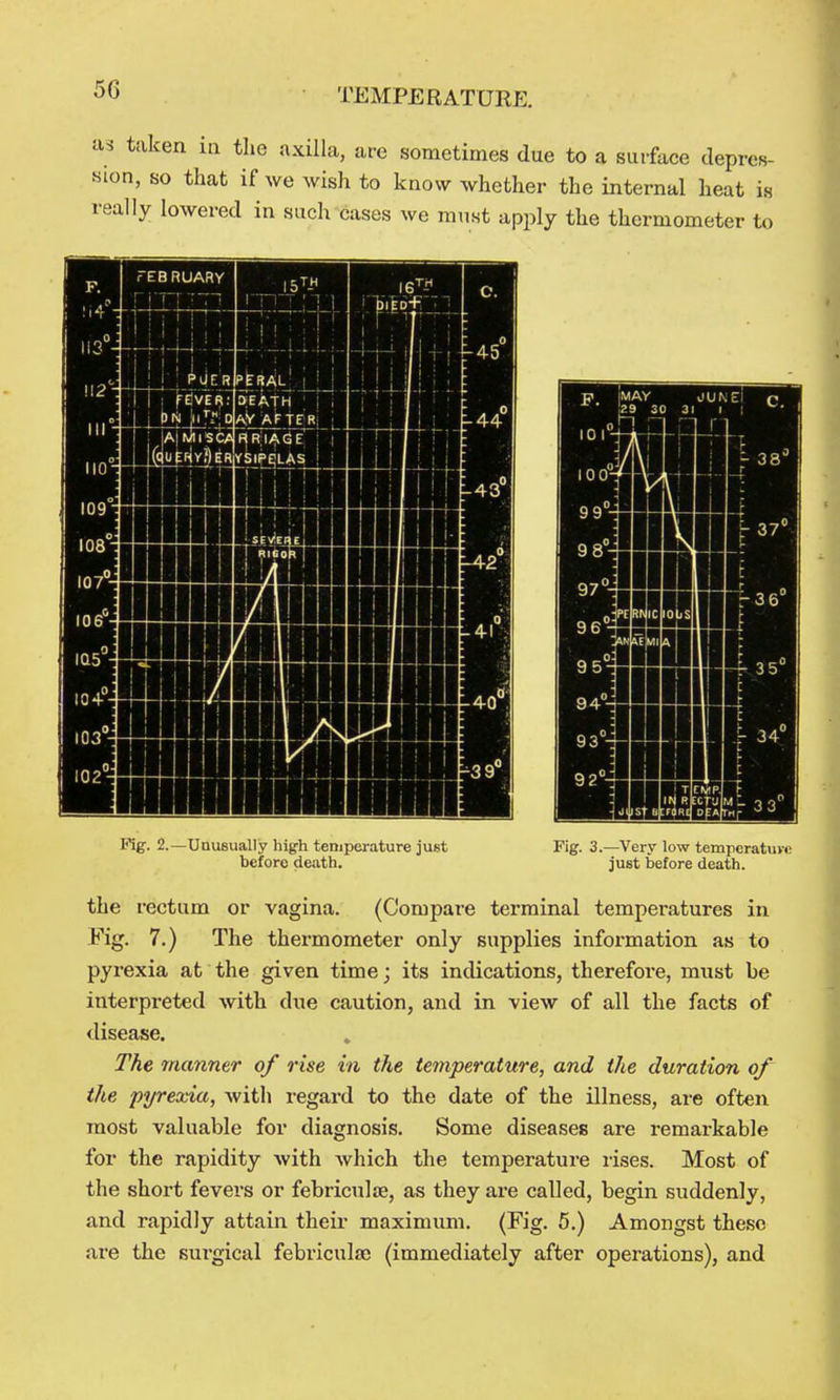 as taken in the axilla, are sometimes due to a surface depres- sion, so that if we wish to know whether the internal heat is really lowered in such^cases we must apply the thermometer to Fig. 2.- -Uuusually high temperature just before death. Fig. 3.—Very low tempcratuvc just before death. the rectum or vagina. (Compare terminal temperatures in Eig. 7.) The thermometer only supplies information as to pyrexia at the given time; its indications, therefore, must be interpreted with due caution, and in view of all the facts of disease. The manner of rise in the temperature, and the duration of the pyrexia, Avith regard to the date of the illness, are often most valuable for diagnosis. Some diseases are remarkable for the rapidity with which the temperature lises. Most of the short fevers or febriculae, as they are called, begin suddenly, and rapidly attain their maximum. (Fig. 5.) Amongst these are the surgical febriculaj (immediately after operations), and