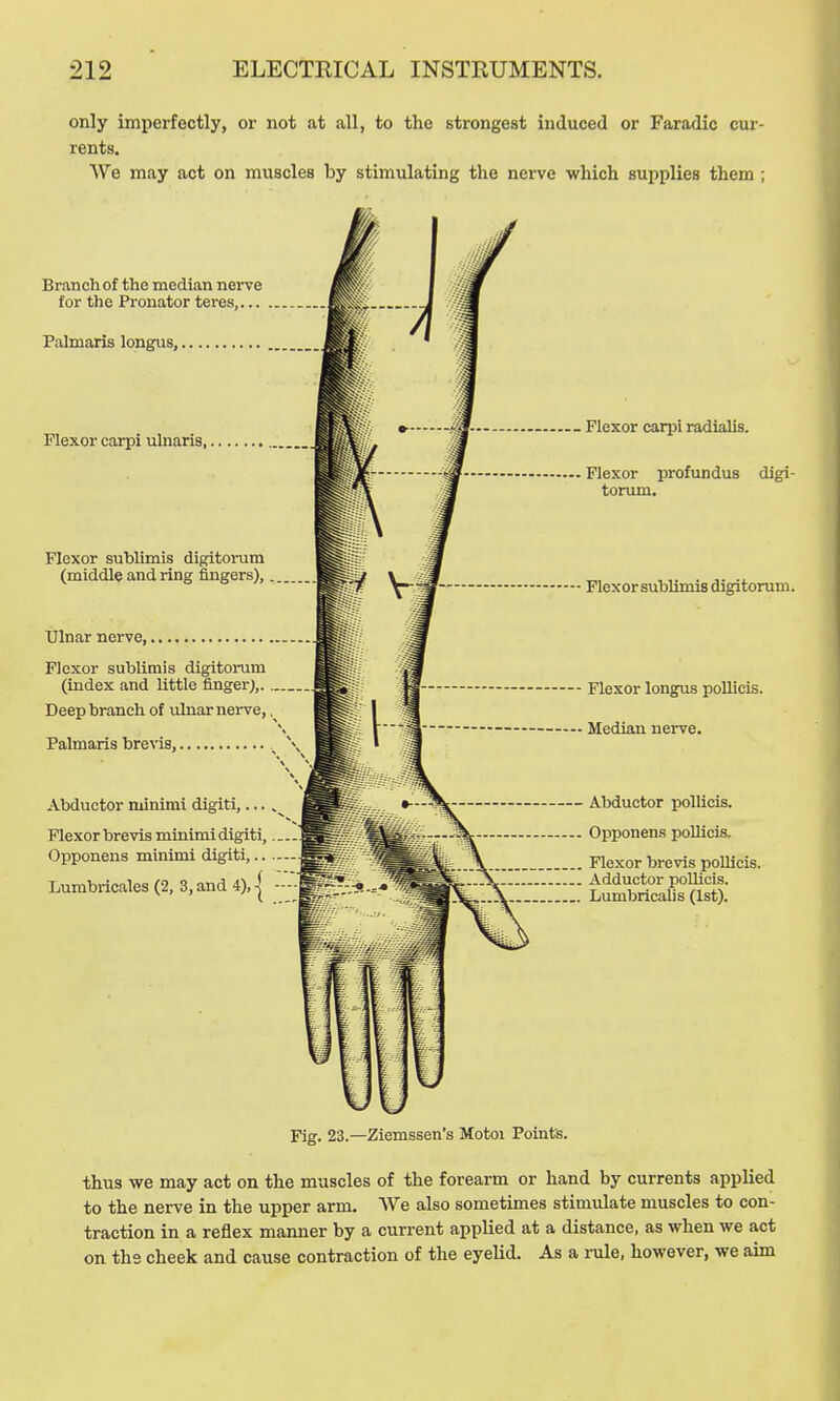 only imperfectly, oi' not at all, to the strongest induced or Faradic cur- rents. We may act on muscles by stimulating the nerve which supplies them; Branch of the median nerve for the Pronator teres, Palmaris longus, Flexor carpi ulnaris, Flexor sublimis digitorum (middle and ring fingers), Ulnar nerve, Flexor sublimis digitorum (index and little finger;,. Deep branch of ulnar nerve, Palmaris brevis, Abductor minimi digiti,... Flexor brevis minimi digiti, Opponens minimi digiti, Lurabricales (2, 3, and 4), Flexor carpi radialis. Flexor profundus digi- torum. Flexor sublimis digitorum. Flexor longus pollicis. Median nerve. Abductor pollicis. Opponens pollicis. Flexor brevis poUicis. Adductor poUicis. Lumbricalis (1st). Fig. 23.—Ziemssen's Motoi Point's. thus we may act on the muscles of the forearm or hand by currents applied to the nerve in the upper arm. We also sometimes stimulate muscles to con- traction in a reflex manner by a current applied at a distance, as when we act on the cheek and cause contraction of the eyelid. As a rule, however, we aim