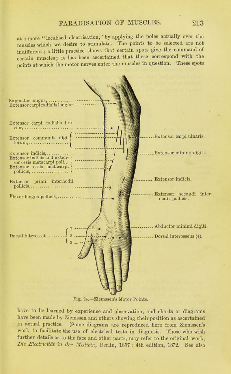 at a more localised electrisation, by applying the poles actually over the muscles which we desii-e to stimulate. The points to be selected are not indifferent; a little practice shows that certain spots give the command of certain muscles; it has been ascei-tained that these correspond with the points at which the motor nerves enter the muscles in question. These spots Supinator longus, Extensor carpi radialis longior Extensor carpi radialis bre vior, Extensor communis digi torum, Extensor indicis, Extensor indicis and exten- ) sor ossis metacarpi poll.,, j Extensor ossis metacarpi) poUicis, i Extensor primi internodii pollicis, Flexor longus pollicis, Dorsal interossei,. Extensor carpi ulnaris. .Extensor minimi digiti. Extensor indicis. Extensor secuiidi inter- nodii pollicis. Abductor minimi digiti. Dorsal intei-osseus (4). 24.—Ziemssen's Motor Points. have to be learned by experience and observation, and charts or diagi-ams have been made by Ziemssen and others showing their position as ascertained in actual practice. (Some diagrams are reproduced here from Ziemssen's work to facilitate the use of electrical tests in diagnosis. Those who wish further details as to the face and other parts, may refer to the original work. Die Ulectricitat in dcr Medicin, Berlin, 1857 ; 4th edition, 1872. See also