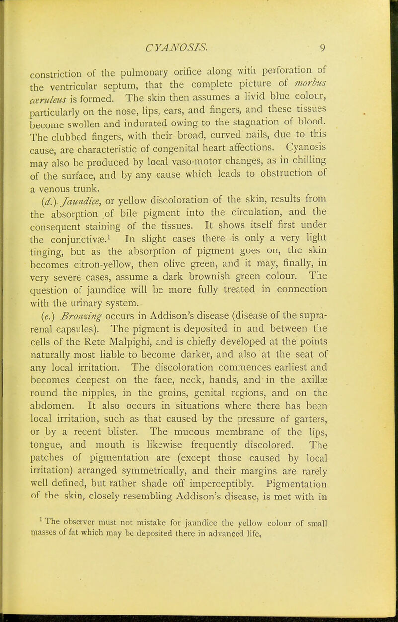constriction of the pulmonary orifice along with perforation of the ventricular septum, that the complete picture of morbus cceruleus is formed. The skin then assumes a livid blue colour, particularly on the nose, lips, ears, and fingers, and these tissues become swollen and indurated owing to the stagnation of blood. The clubbed fingers, with their broad, curved nails, due to this cause, are characteristic of congenital heart affections. Cyanosis may also be produced by local vaso-motor changes, as in chilling of the surface, and by any cause which leads to obstruction of a venous trunk. (d.)Jaundice, or yellow discoloration of the skin, results from the absorption of bile pigment into the circulation, and the consequent staining of the tissues. It shows itself first under the conjunctiva?.1 In slight cases there is only a very light tinging, but as the absorption of pigment goes on, the skin becomes citron-yellow, then olive green, and it may, finally, in very severe cases, assume a dark brownish green colour. The question of jaundice will be more fully treated in connection with the urinary system. (e.) Bronzing occurs in Addison's disease (disease of the supra- renal capsules). The pigment is deposited in and between the cells of the Rete Malpighi, and is chiefly developed at the points naturally most liable to become darker, and also at the seat of any local irritation. The discoloration commences earliest and becomes deepest on the face, neck, hands, and in the axillae round the nipples, in the groins, genital regions, and on the abdomen. It also occurs in situations where there has been local irritation, such as that caused by the pressure of garters, or by a recent blister. The mucous membrane of the lips, tongue, and mouth is likewise frequently discolored. The patches of pigmentation are (except those caused by local irritation) arranged symmetrically, and their margins are rarely well defined, but rather shade off imperceptibly. Pigmentation of the skin, closely resembling Addison's disease, is met with in 1 The observer must not mistake for jaundice the yellow colour of small masses of fat which may be deposited there in advanced life,