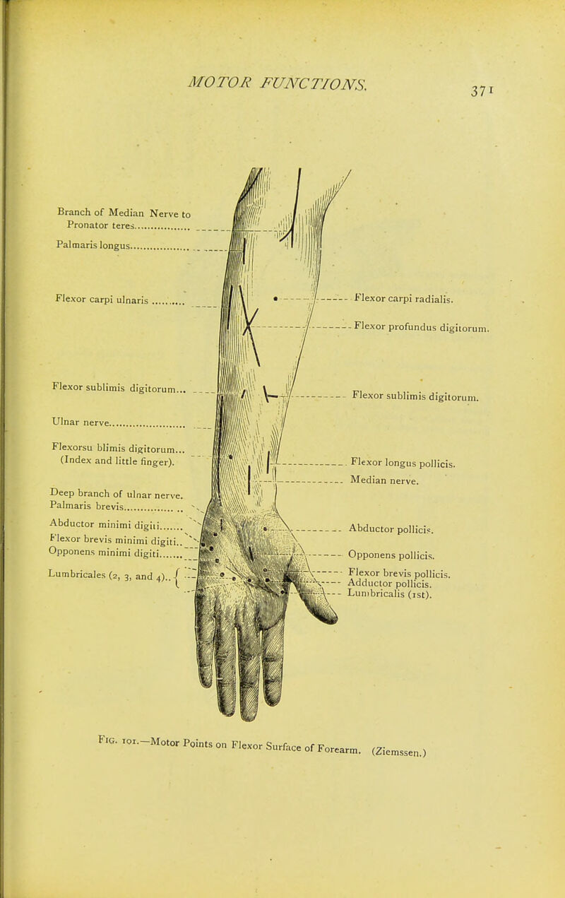 37i Branch of Median Nerve to Pronator teres Pal maris longus Flexor carpi ulnaris Flexor sublimis digitorum... Ulnar nerve.. Flexorsu blimis digitorum... (Index and little finger). Deep branch of ulnar nerve. Palmaris brevis Abductor minimi digiii Flexor brevis minimi digiti.. Opponens minimi digiti Lumbricales (2, 3, and 4).. j ■ Flexor carpi radialis. Flexor profundus digitorum. Flexor sublimis digitorum. Flexor longus pollicis. Median nerve. Abductor pollicis. Opponens pollicis. Flexor brevis pollicis. Adductor pollicis. Lunibricalis (1st). Fig. ioi.-Motor Points on Flexor Surface of Forearm. (Ziemssen.)