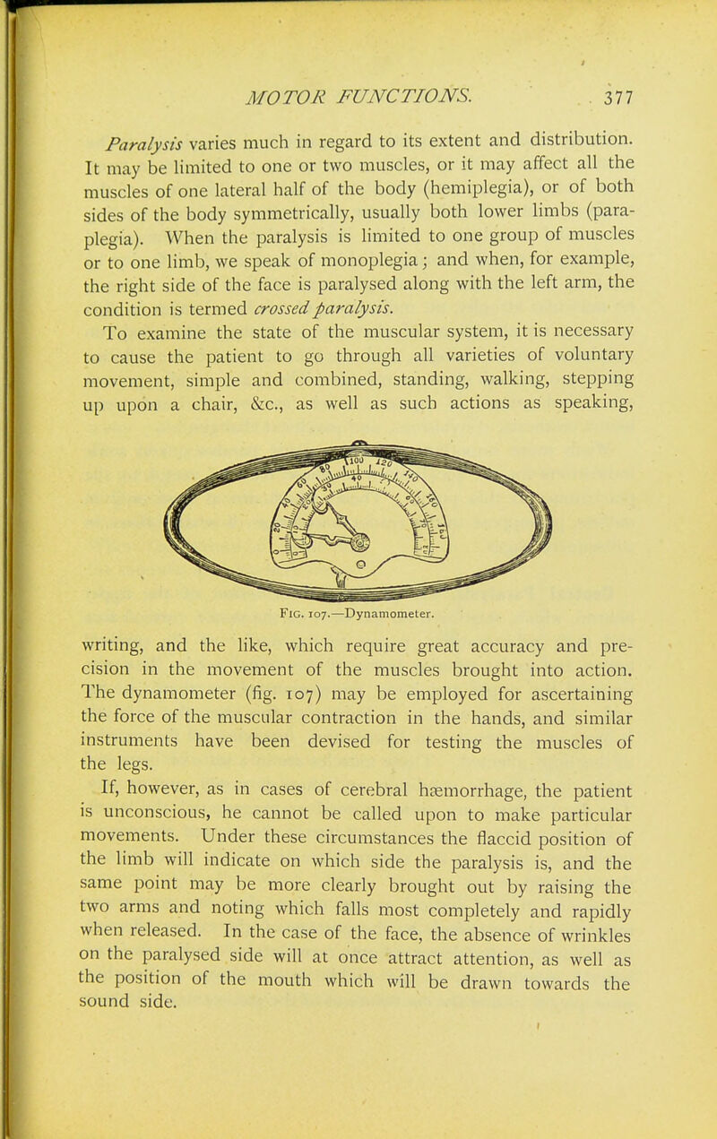Paralysis varies much in regard to its extent and distribution. It may be limited to one or two muscles, or it may affect all the muscles of one lateral half of the body (hemiplegia), or of both sides of the body symmetrically, usually both lower limbs (para- plegia). When the paralysis is limited to one group of muscles or to one limb, we speak of monoplegia; and when, for example, the right side of the face is paralysed along with the left arm, the condition is termed crossed paralysis. To examine the state of the muscular system, it is necessary to cause the patient to go through all varieties of voluntary movement, simple and combined, standing, walking, stepping up upon a chair, &c, as well as such actions as speaking, Fig. 107.—Dynamometer. writing, and the like, which require great accuracy and pre- cision in the movement of the muscles brought into action. The dynamometer (fig. 107) may be employed for ascertaining the force of the muscular contraction in the hands, and similar instruments have been devised for testing the muscles of the legs. If, however, as in cases of cerebral haemorrhage, the patient is unconscious, he cannot be called upon to make particular movements. Under these circumstances the flaccid position of the limb will indicate on which side the paralysis is, and the same point may be more clearly brought out by raising the two arms and noting which falls most completely and rapidly when released. In the case of the face, the absence of wrinkles on the paralysed side will at once attract attention, as well as the position of the mouth which will be drawn towards the sound side.