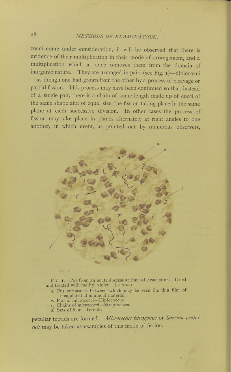 cocci come under consideration, it will be observed that there is evidence of their multiplication in their mode of arrangement, and a multiplication which at once removes them from the domain of inorganic nature. They are arranged in pairs (see Fig. i)—diplococci —as though one had grown from the other by a process of cleavage or partial fission. This process may have been continued so that, instead of a single pair, there is a chain of some length made up of cocci of the same shape and of equal size, the fission taking place in the same plane at each successive division. In other cases the process of fission may take place in planes alternately at right angles to one another, in which event, as pointed out by numerous observers, a. J.TT. Fig. I.—Pus from an acute abscess at lime of evacuation. Dried and treated with methyl violet. ( x 700.) a. Pus corpuscles between which may be seen the thin film of coagulated albuminoid material. Pair of micrococci—Diplococcus. c. Chains of micrococci—Streptococci. d. Sets of four—Tetrads. peculiar tetrads are formed. Micrococcus tetragonus or Sarcina vcntri- culi may be taken as examples of this mode of fission.