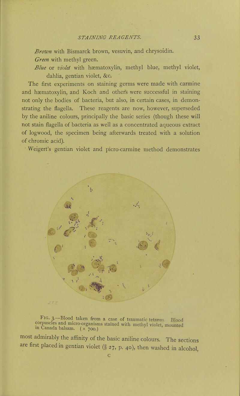 Brown with Bismarck brown, vesuvin, and chrysoidin. Green with methyl green. Blue or violet with hsematoxylin, methyl blue, methyl violet, dahlia, gentian violet, &c. The first experiments on staining germs were made with carmine and hsematoxylin, and Koch and others were successful in staining not only the bodies of bacteria, but also, in certain cases, in demon- strating the flagella. These reagents are now, however, superseded by the aniline colours, principally the basic series (though these will not stain flagella of bacteria as well as a concentrated aqueous extract of logwood, the specimen being afterwards treated with a solution of chromic acid). ■ Weigert's gentian violet and picro-carmine method demonstrates Jt.t: Fig. 3.—Blood taken from a case of traumatic tetamis, Blood corpuscles and micro-organisms stained with methyl violet, mounted m Canada balsam. ( x 700.) most admirably the affinity of the basic aniline colours. The sections are first placed in gentian violet (§ 27, p. 40), then washed in alcohol,