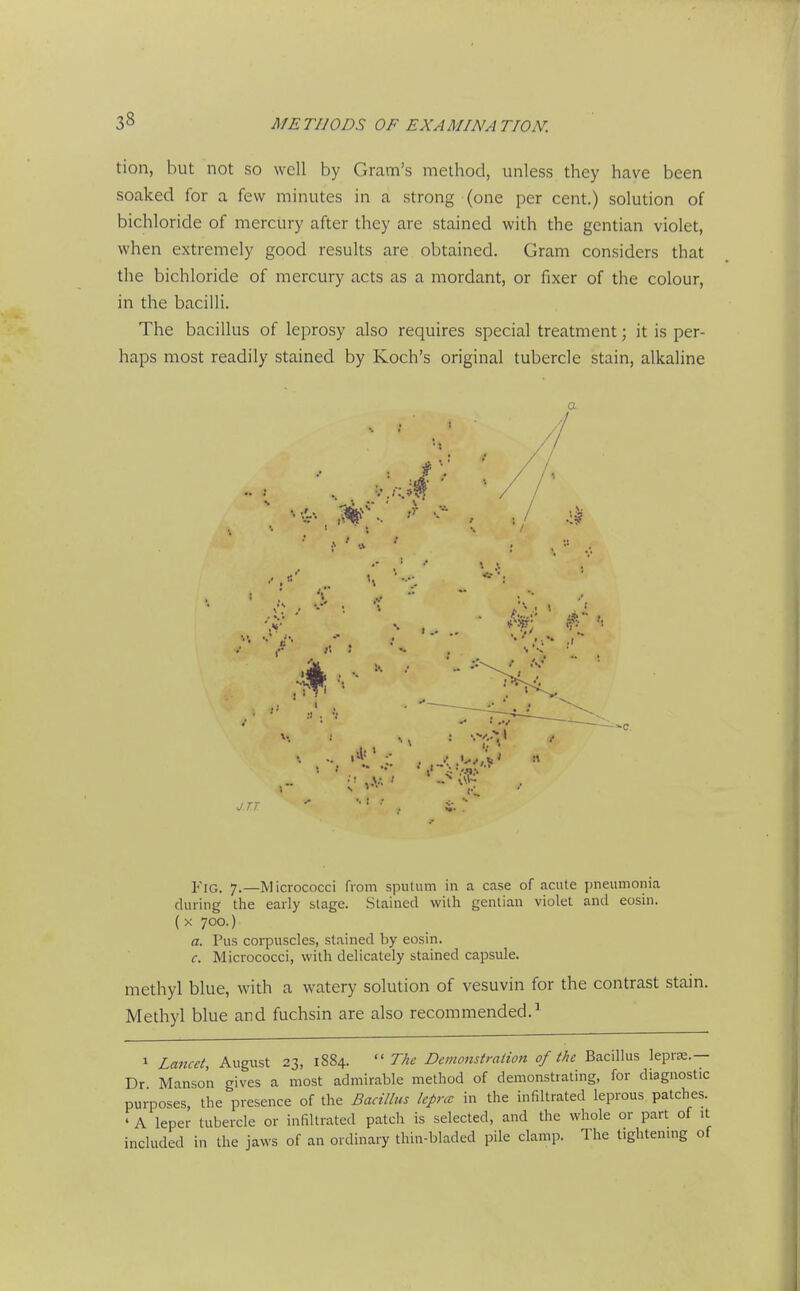 tion, but not so well by Gram's method, unless they have been soaked for a few minutes in a strong (one per cent.) solution of bichloride of mercury after they are stained with the gentian violet, when extremely good results are obtained. Gram considers that the bichloride of mercury acts as a mordant, or fixer of the colour, in the bacilli. The bacillus of leprosy also requires special treatment; it is per- haps most readily stained by Koch's original tubercle stain, alkaline yiG. 7.—Micrococci from sputum in a case of acute jmeumonia during the early stage. Stained with genliau violet and eosin. ( X 700.) a. Pus corpuscles, stained by eosin. c. Micrococci, with delicately stained capsule. methyl blue, with a watery solution of vesuvin for the contrast stain. Methyl blue and fuchsin are also recommended.' 1 Lancet, August 23, 1884.  The Demonstration of the Bacillus leprEC.— Dr Mansoii gives a most admirable method of demonstrating, for diagnostic purposes, the presence of the Bacillus kprcc in the infiltrated leprous patches. ' A leper tubercle or infiltrated patch is selected, and the whole or part of it included in the jaws of an ordinary thin-bladed pile clamp. The tightenmg of