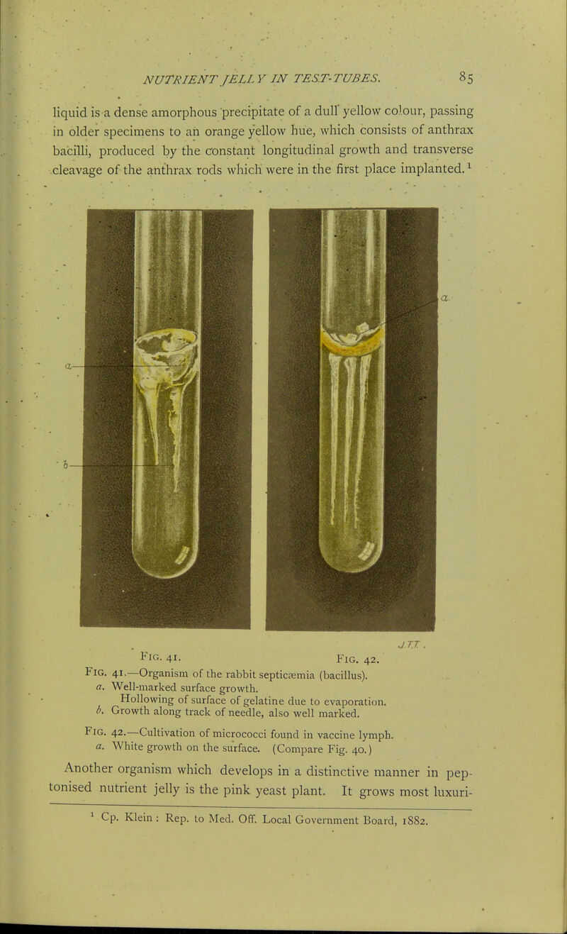 liquid is a dense amorphous precipitate of a dull yellow colour, passing in older specimens to an orange yellow hue, which consists of anthrax bacilli, produced by the constant longitudinal growth and transverse cleavage of the anthrax rods which were in the first place implanted. ^ a. J.TJ . Fig. 41. Fig. 42. Fig. 41.—Organism of the rabbit septicismia (bacillus). a. Well-marked surface growth. Hollowing of surface of gelatine due to evaporation. b. Growth along track of needle, also well marked. Fig. 42.—Cultivation of micrococci found in vaccine lymph. a. White growth on the surface. (Compare Fig. 40.) Another organism which develops in a distinctive manner in pep- tonised nutrient jelly is the pink yeast plant. It grows most luxuri- ^ Cp. Klein : Rep. to Med. Off. Local Government Board, 1882.