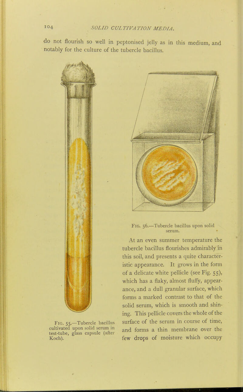 do not flourish so well in peptonised jelly as in this medium, and notably for the culture of the tubercle bacillus. Fig. 55.—Tubercle bacillus cultivated upon solid serum in test-tube, glass capsule (after Koch). Fig. 56.—Tubercle bacillus upon solid serum. At an even summer temperature the tubercle bacillus flourishes admirably in this soil, and presents a quite character- istic appearance. It grows in the form of a dehcate white pellicle (see Fig. 55), which has a flaky, almost fluffy, appear- ance, and a dull granular surface, which forms a marked contrast to that of the solid serum, which is smooth and shin- ing. This pellicle covers the whole of the surface of the serum in course of time, and forms a thin membrane over the few drops of moisture which occupy