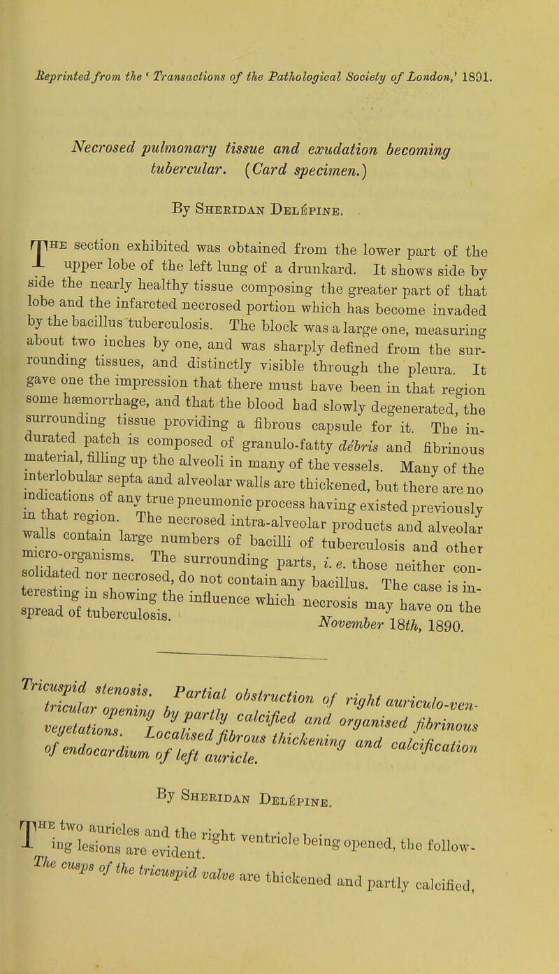 Reprinted from the ' Transactions of the Pathological Society of London,* 1891. Necrosed pulmonary tissue and exudation becoming tubercular. [Card specimen.) By Sheridan Del^pine. mHE section exhibited was obtained from the lower part of the J- upper lobe of the left lung of a drunkard. It shows side by side the nearly healthy tissue composing the greater part of that lobe and the infarcted necrosed portion which has become invaded by the bacillus tuberculosis. The block was a large one, measuring about two inches by one, and was sharply denned from the sur- rounding tissues, and distinctly visible through the pleura It gave one the impression that there must have been in that region some hemorrhage, and that the blood had slowly degenerated, the surrounding tissue providing a fibrous capsule for it The in- durated patch is composed of granulo-fatty ddbris and fibrinous material filling up the alveoli in many of the vessels. Many of the interlobular septa and alveolar walls are thickened, but there are no ZZ T anWUePneUm°niCPr°CeSStavi^existedPiously m that region The necrosed intra-alveolar products and alveolar walls contain large numbers of bacilli of tuberculosis and othe micro-oi?anisms. The surrounding parts, i.e. those neither on olidated nor necrosed, do not contain any bacillus. The case is in November 18th, 1890. By Sheridan Delepine. t™;:l right —*. f„w * of«. «^ valve m thicWd Md partiy