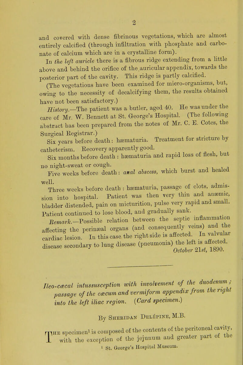and covered with dense fibrinous vegetations, which are almost entirely calcified (through infiltration with phosphate and carbo- nate of calcium which are in a crystalline form). In the left auricle there is a fibrous ridge extending from a little above and behind the orifice of the auricular appendix, towards the posterior part of the cavity. This ridge is partly calcified. (The vegetations have been examined for micro-organisms, but, owing to the necessity of decalcifying them, the results obtained have not been satisfactory.) History.—The patient was a butler, aged 40. He was under the care of Mr. W. Bennett at St. George's Hospital. (The following abstract has been prepared from the notes of Mr. C. E. Cotes, the Surgical Eegistrar.) Six years before death: hsematuria. Treatment for stricture by catheterism. Eecovery apparently good. Six months before death : hsematuria and rapid loss of flesh, but no night-sweat or cough. Five weeks before death: anal abscess, which burst and healed W6Three weeks before death : hsematuria, passage of clots, admis- sion into hospital. Patient was then very thin and aneemic, bladder distended, pain on micturition, pulse very rapid and small. Patient continued to lose blood, and gradually sank. Remark.-Possible relation between the septic inflammation affecting the perineal organs (and consequently veins) and the cardiac lesion. In this case the right side is affected In valvular disease secondary to lung disease <*^>^^^ Ileo-cacal intussusception with involvement of the duodenum; passage of the ccecum and vermiform appendix from the right into the left iliac region. {Card specimen.) By Sheridan DelGpine, M.B. mHE specimen is composed of the contents of the peritoneal cavity 1 with the exception of the jejunum and greater part of the 1 St. George's Hospital Museum.