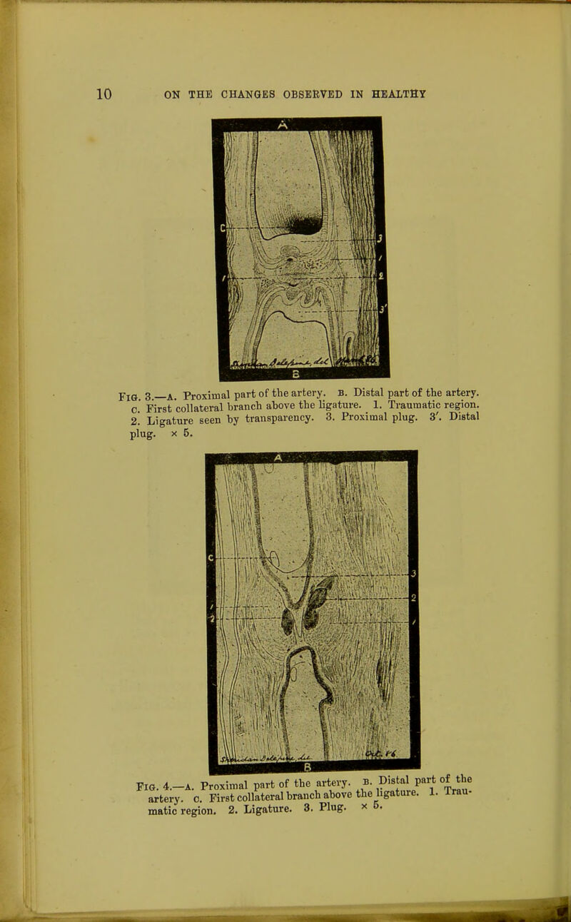 A pIG 3 A> pr0ximal part of the artery. B. Distal part of the artery. c' First collateral branch above the ligature. 1. Traumatic region. 2. Ligature seen by transparency. 3. Proximal plug. 3'. Distal
