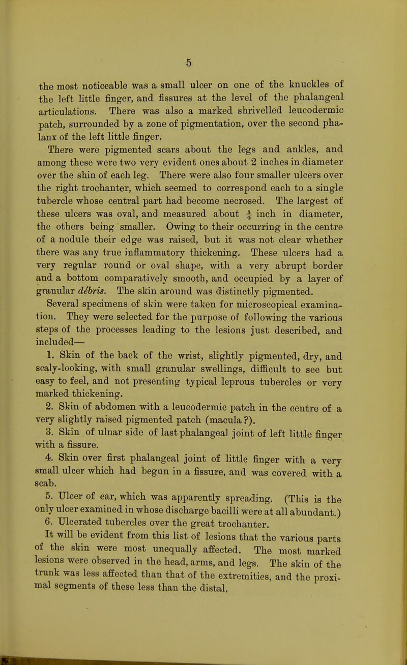 the most noticeable was a small ulcer on one of the knuckles of the left little finger, and fissures at the level of the phalangeal articulations. There was also a marked shrivelled leucodermic patch, surrounded by a zone of pigmentation, over the second pha- lanx of the left little finger. There were pigmented scars about the legs and ankles, and among these were two very evident ones about 2 inches in diameter over the shin of each leg. There were also four smaller ulcers over the right trochanter, which seemed to correspond each to a single tubercle whose central part had become necrosed. The largest of these ulcers was oval, and measured about f inch in diameter, the others being smaller. Owing to their occurring in the centre of a nodule their edge was raised, but it was not clear whether there was any true inflammatory thickening. These ulcers had a very regular round or oval shape, with a very abrupt border and a bottom comparatively smooth, and occupied by a layer of granular debris. The skin around was distinctly pigmented. Several specimens of skin were taken for microscopical examina- tion. They were selected for the purpose of following the various steps of the processes leading to the lesions just described, and included— 1. Skin of the back of the wrist, slightly pigmented, dry, and scaly-looking, with small granular swellings, difficult to see but easy to feel, and not presenting typical leprous tubercles or very marked thickening. 2. Skin of abdomen with a leucodermic patch in the centre of a very slightly raised pigmented patch (macula ?). 3. Skin of ulnar side of last phalangeal joint of left little finger with a fissure. 4. Skin over first phalangeal joint of little finger with a very small ulcer which had begun in a fissure, and was covered with a scab. 5. Ulcer of ear, which was apparently spreading. (This is the only ulcer examined in whose discharge bacilli were at all abundant.) 6. Ulcerated tubercles over the great trochanter. It will be evident from this list of lesions that the various parts of the skin were most unequally affected. The most marked lesions were observed in the head, arms, and legs. The skin of the trunk was less affected than that of the extremities, and the proxi- mal segments of these less than the distal.