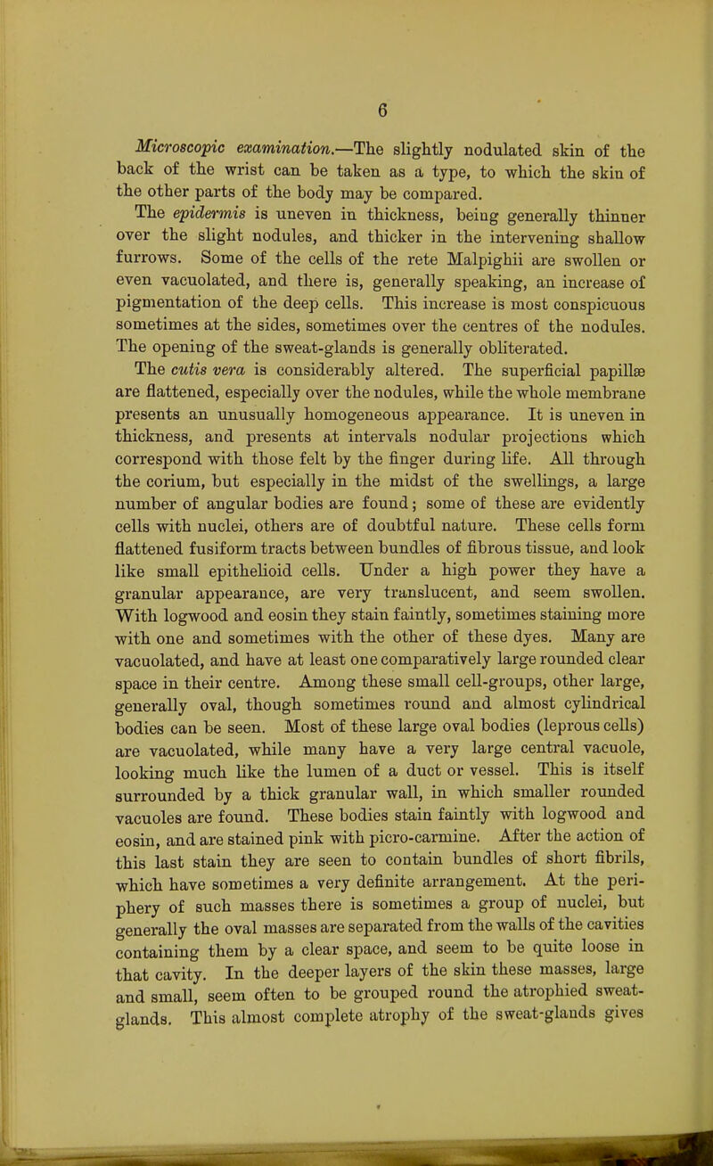 G Microscopic examination.—The slightly nodulated skin of tlie back of the wrist can be taken as a type, to which the skin of the other parts of the body may be compared. The epidermis is uneven in thickness, being generally thinner over the slight nodules, and thicker in the intervening shallow furrows. Some of the cells of the rete Malpighii are swollen or even vacuolated, and there is, generally speaking, an increase of pigmentation of the deep cells. This increase is most conspicuous sometimes at the sides, sometimes over the centres of the nodules. The opening of the sweat-glands is generally obliterated. The cutis vera is considerably altered. The superficial papillae are flattened, especially over the nodules, while the whole membrane presents an unusually homogeneous appearance. It is uneven in thickness, and presents at intervals nodular projections which correspond with those felt by the finger during life. All through the corium, but especially in the midst of the swellings, a large number of angular bodies are found; some of these are evidently cells with nuclei, others are of doubtful nature. These cells form flattened fusiform tracts between bundles of fibrous tissue, and look like small epithelioid cells. Under a high power they have a granular appearance, are very translucent, and seem swollen. With logwood and eosin they stain faintly, sometimes staining more with one and sometimes with the other of these dyes. Many are vacuolated, and have at least one comparatively large rounded clear space in their centre. Among these small cell-groups, other large, generally oval, though sometimes round and almost cylindrical bodies can be seen. Most of these large oval bodies (leprous cells) are vacuolated, while many have a very large central vacuole, looking much like the lumen of a duct or vessel. This is itself surrounded by a thick granular wall, in which smaller rounded vacuoles are found. These bodies stain faintly with logwood and eosin, and are stained pink with picro-carmine. After the action of this last stain they are seen to contain bundles of short fibrils, which have sometimes a very definite arrangement. At the peri- phery of such masses there is sometimes a group of nuclei, but generally the oval masses are separated from the walls of the cavities containing them by a clear space, and seem to be quite loose in that cavity. In the deeper layers of the skin these masses, large and small, seem often to be grouped round the atrophied sweat- glands. This almost complete atrophy of the sweat-glands gives