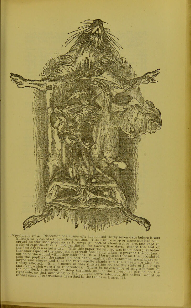 EXPvmSf!', an5.A--DlafB00«0D of a guinea-pig inoculated thirty seven days before it was killed wiiu A cc. of a tuberculous sputum. This uniiuUi uiud i^,, nl I ,H i,.