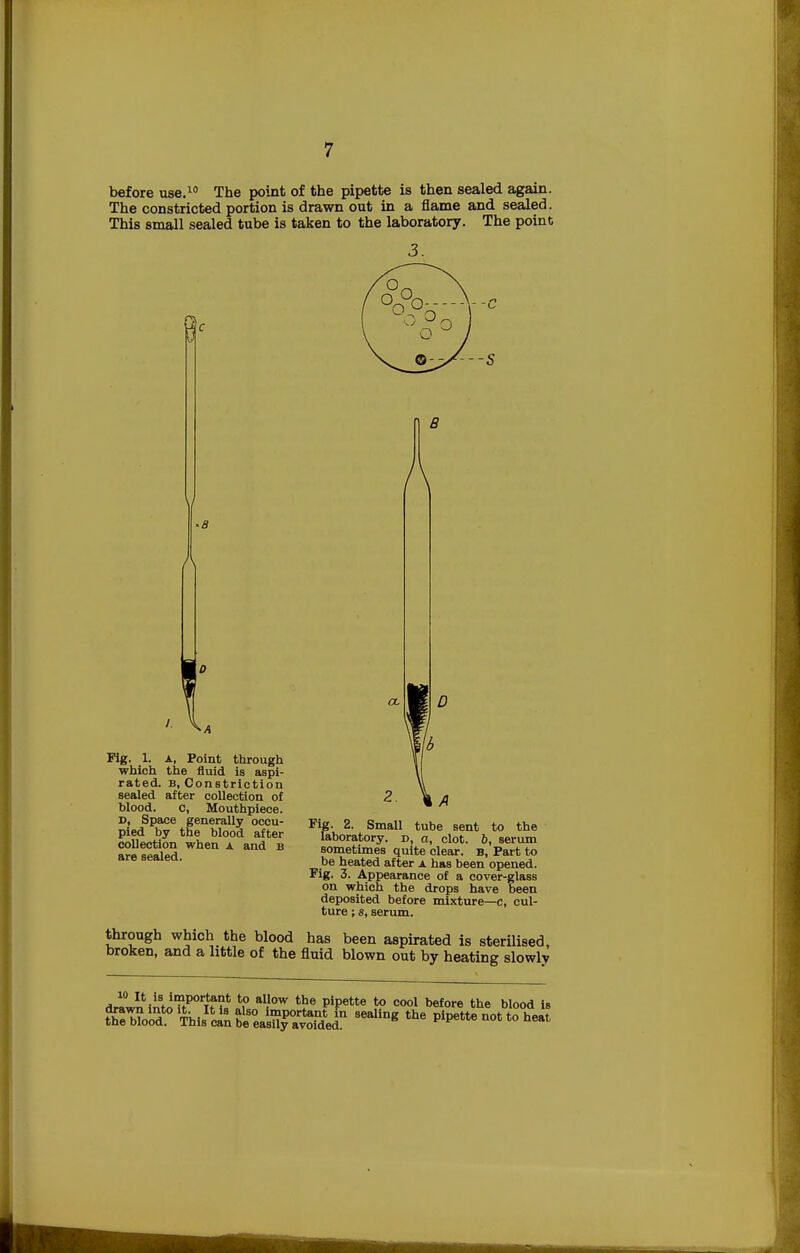 before use.10 The point of the pipette is then sealed again. The constricted portion is drawn out in a flame and sealed. This small sealed tube is taken to the laboratory. The point J B A Fig. 1. a, Point through which the fluid is aspi- rated, b, Constriction sealed after collection of blood. c, Mouthpiece. £«LhL »l d ait6r laboratory, d, a, clot, b, serum a?e sealed B ^metimes quite'clear, b,'Part to are seaiea. be heated after a has been opened. Fig. 3. Appearance of a cover-glass on which the drops have been deposited before mixture—c, cul- ture ; 8, serum. through which the blood has been aspirated is sterilised, broken, and a little of the fluid blown out by heating slowly dr1«0wIntijff,!?fPOrTtf?t *? al-low the P'P66 t0 0001 before the blood is ^oTl^ll^^ilt SealiDg the « not to heat