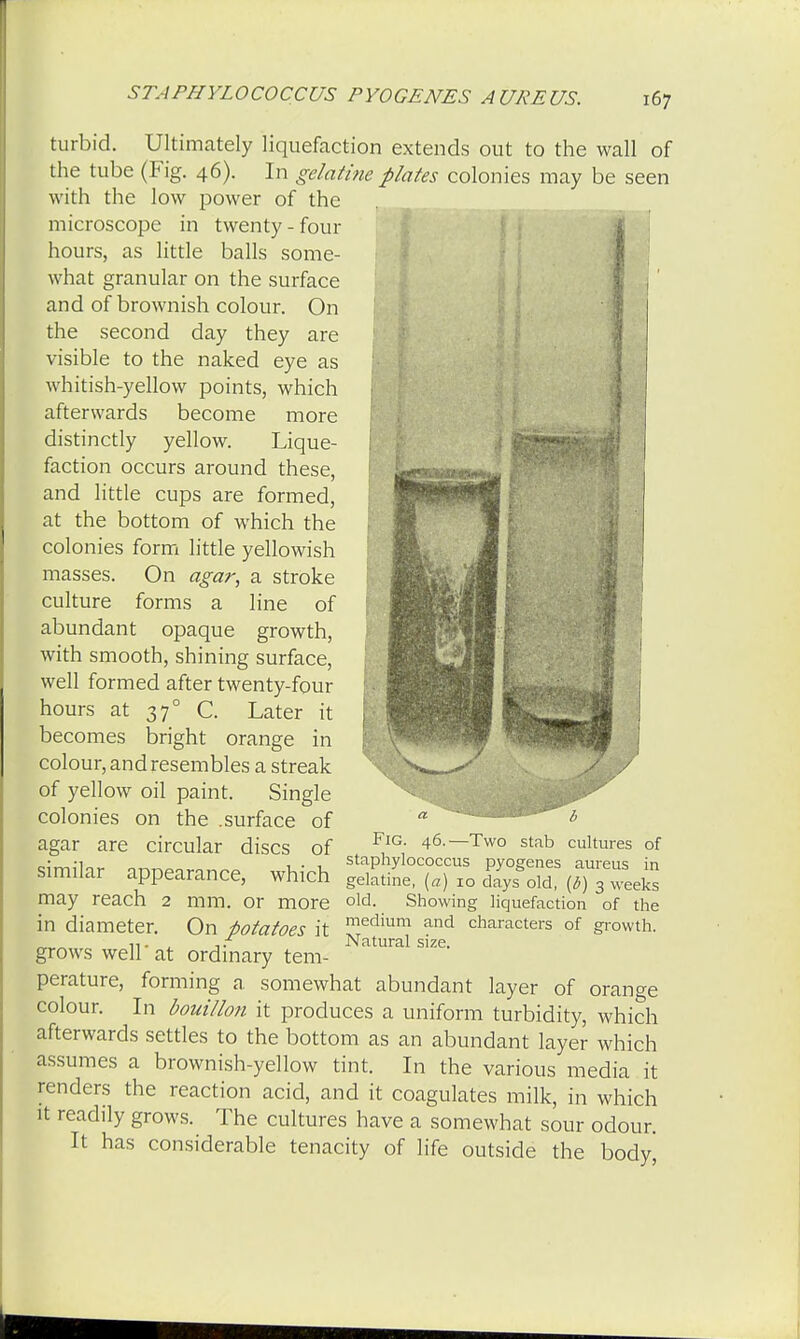 I turbid. Ultimately liquefaction extends out to the wall of the tube (Fig. 46). In gelatine plates colonies may be seen with the low power of the microscope in twenty-four hours, as little balls some- what granular on the surface and of brownish colour. On the second day they are visible to the naked eye as whitish-yellow points, which afterwards become more distinctly yellow. Lique- faction occurs around these, and little cups are formed, at the bottom of which the colonies form little yellowish masses. On agar, a stroke culture forms a line of abundant opaque growth, with smooth, shining surface, well formed after twenty-four hours at 370 C. Later it becomes bright orange in colour, and resembles a streak of yellow oil paint. Single colonies on the .surface of agar are circular discs of similar appearance, which may reach 2 mm. or more in diameter. On potatoes it grows well' at ordinary tem- perature, forming a somewhat abundant layer of orange colour. In bouillon it produces a uniform turbidity, which afterwards settles to the bottom as an abundant layer which assumes a brownish-yellow tint. In the various media it renders the reaction acid, and it coagulates milk, in which it readily grows. The cultures have a somewhat sour odour. It has considerable tenacity of life outside the body, Fig. 46.—Two stab cultures of staphylococcus pyogenes aureus in gelatine, (a) 10 days old, (d) 3 weeks old. Showing liquefaction of the medium and characters of growth. Natural size.